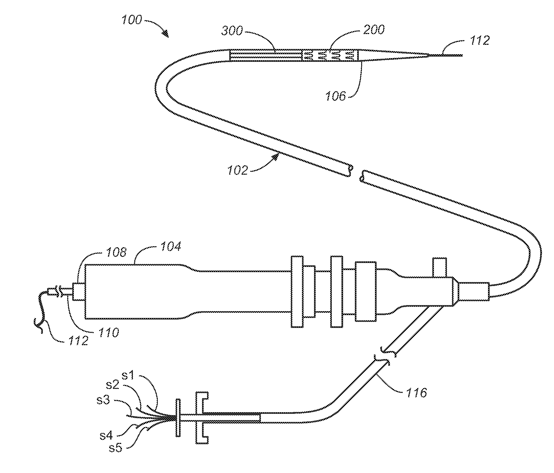 Prosthesis Fixation Apparatus and Methods