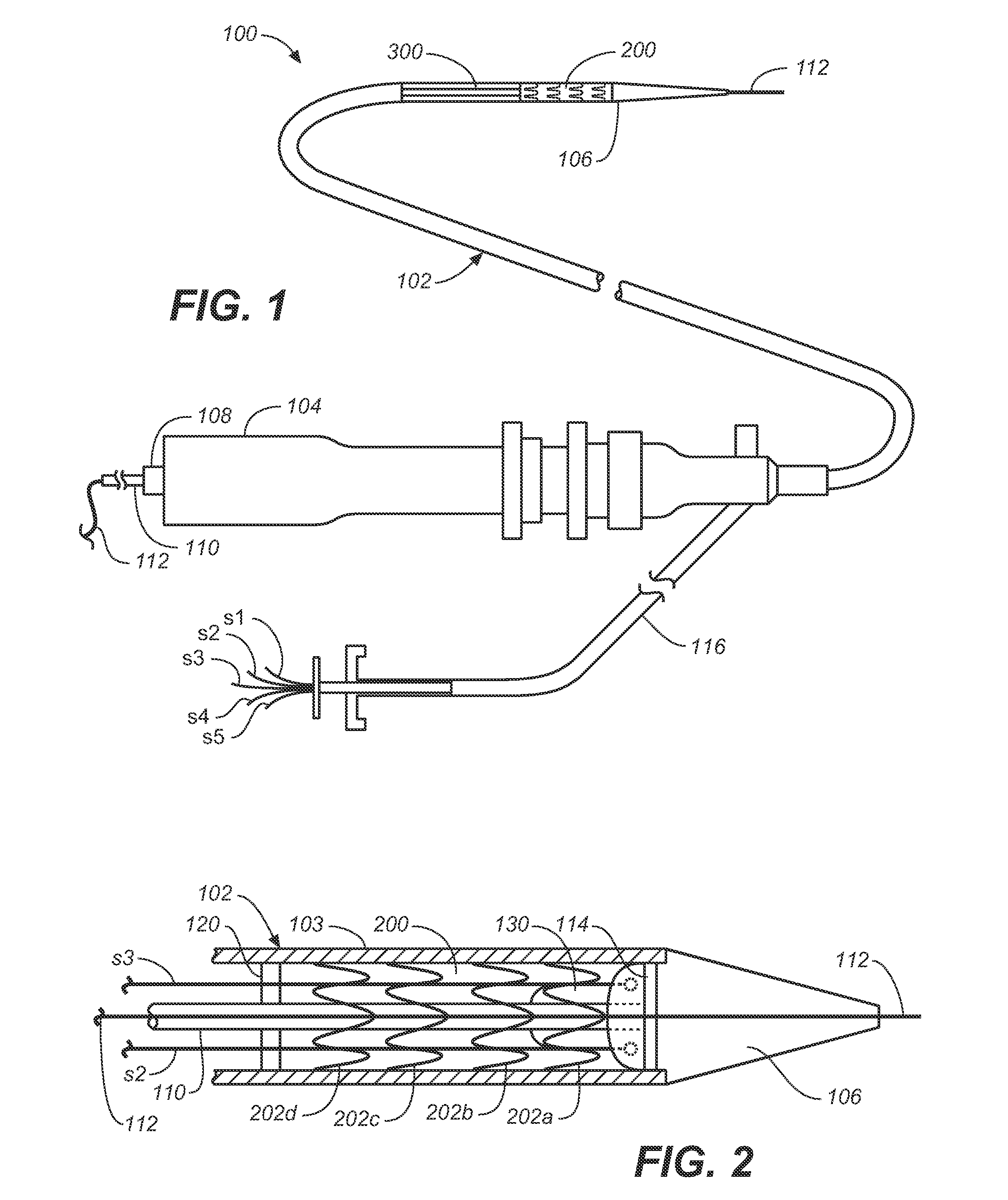 Prosthesis Fixation Apparatus and Methods