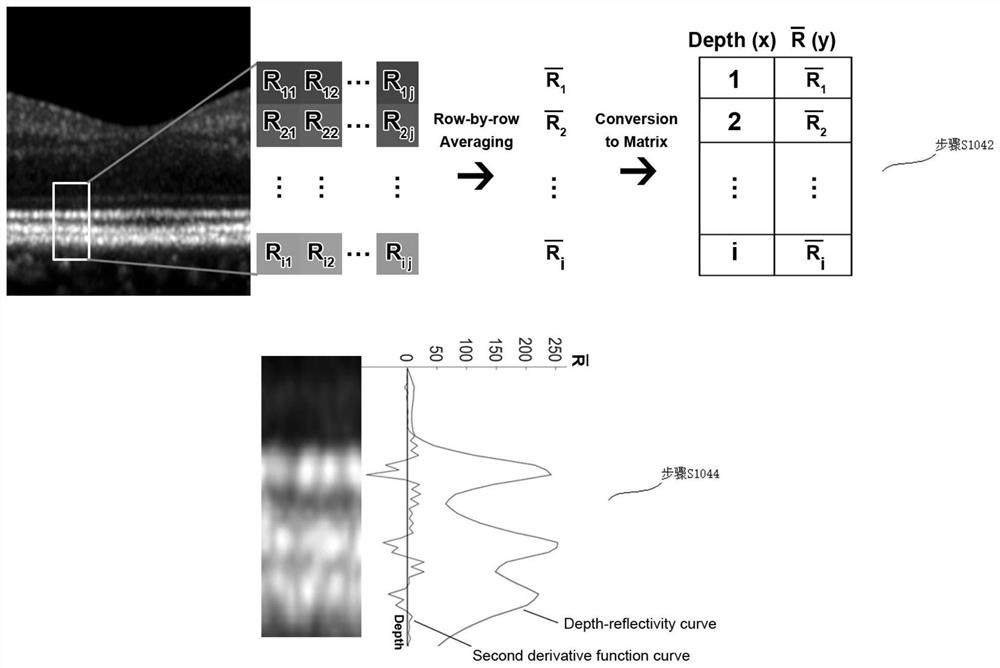 Quantitative detection method based on ophthalmic retina OCT image