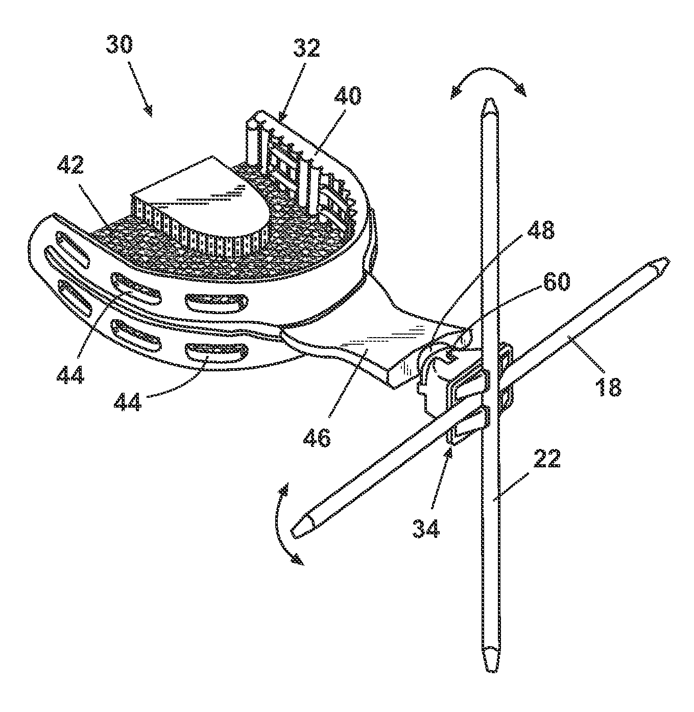 Facial plane indicator