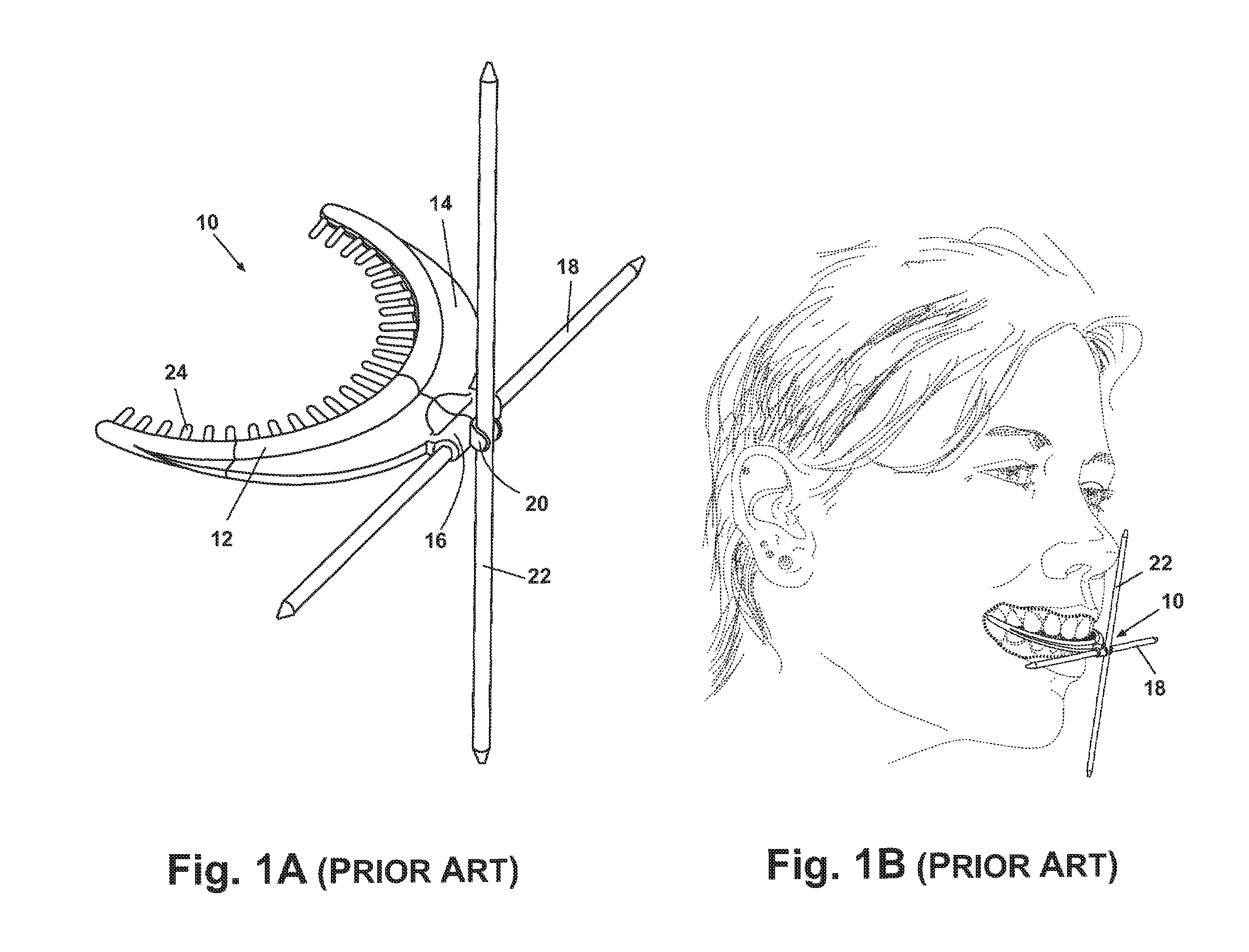 Facial plane indicator