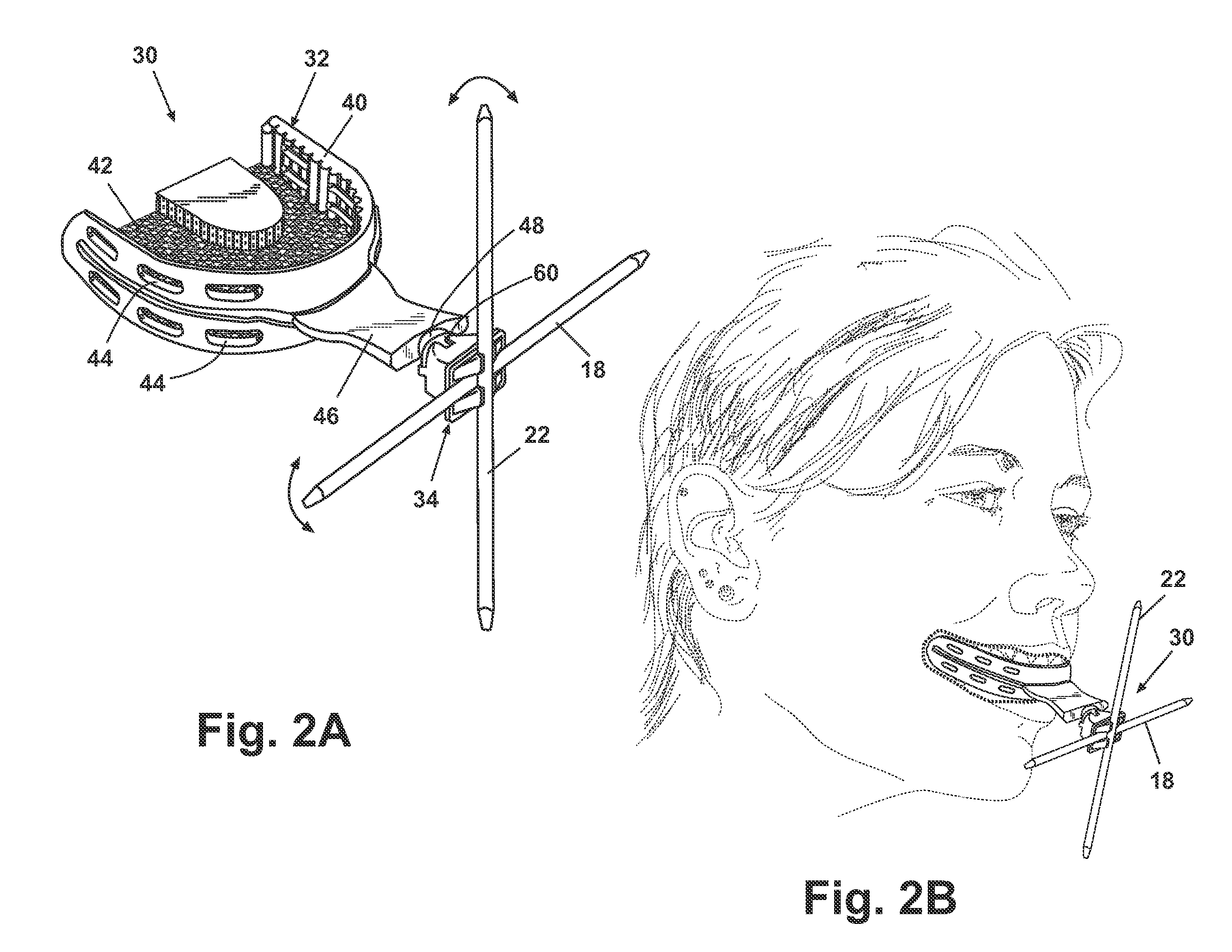 Facial plane indicator