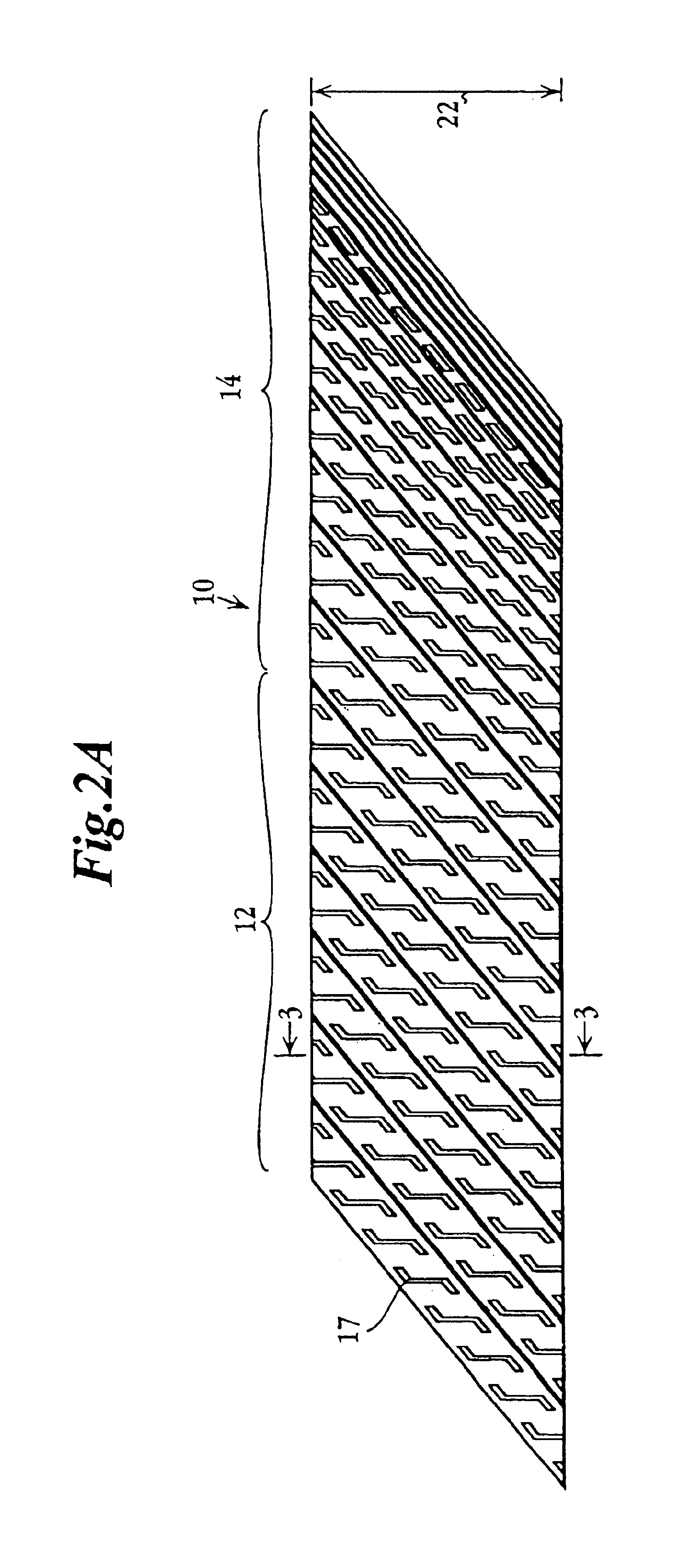 Catheter-stent device