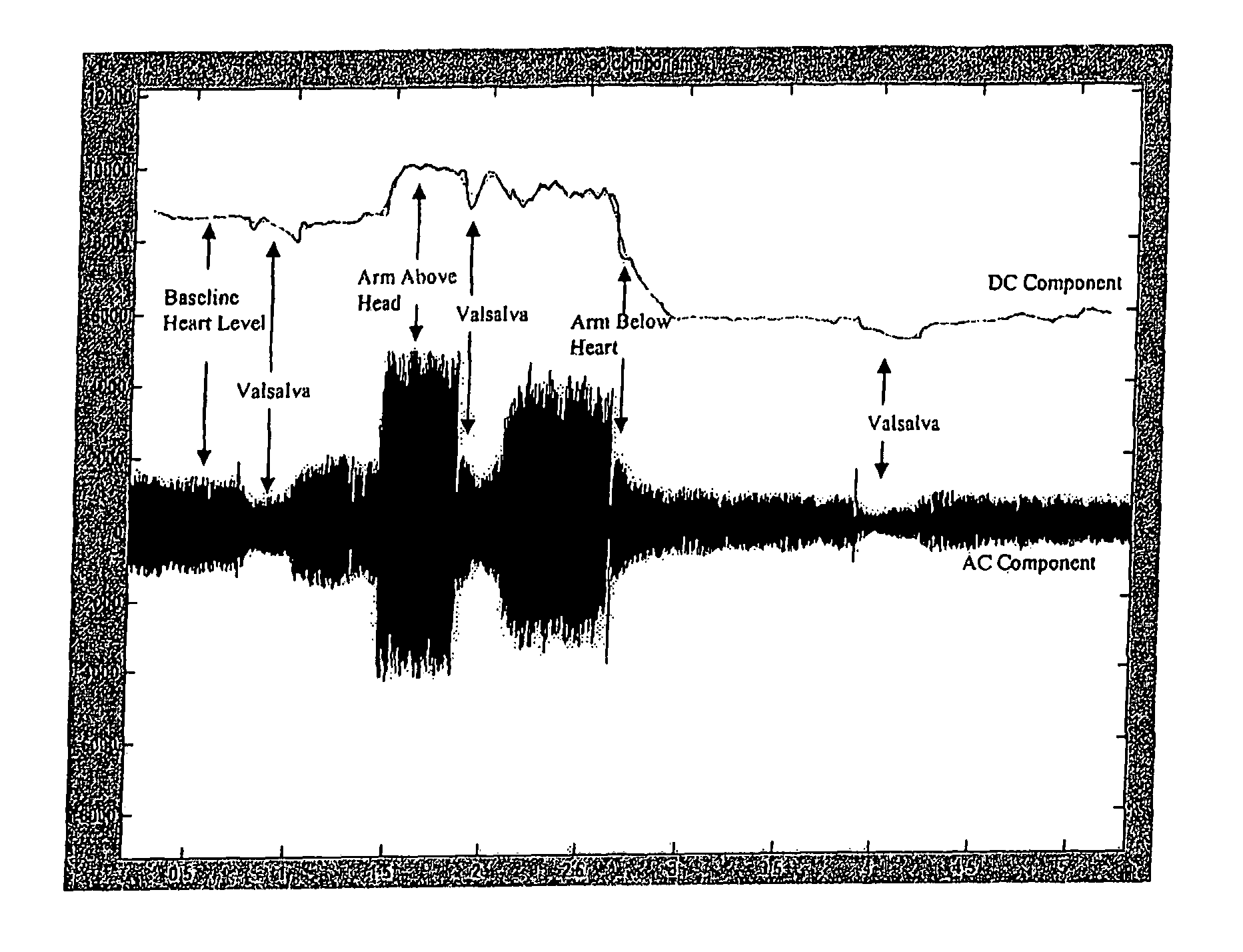 Methods and devices for countering grativity induced loss of consciousness and novel pulse oximeter probes