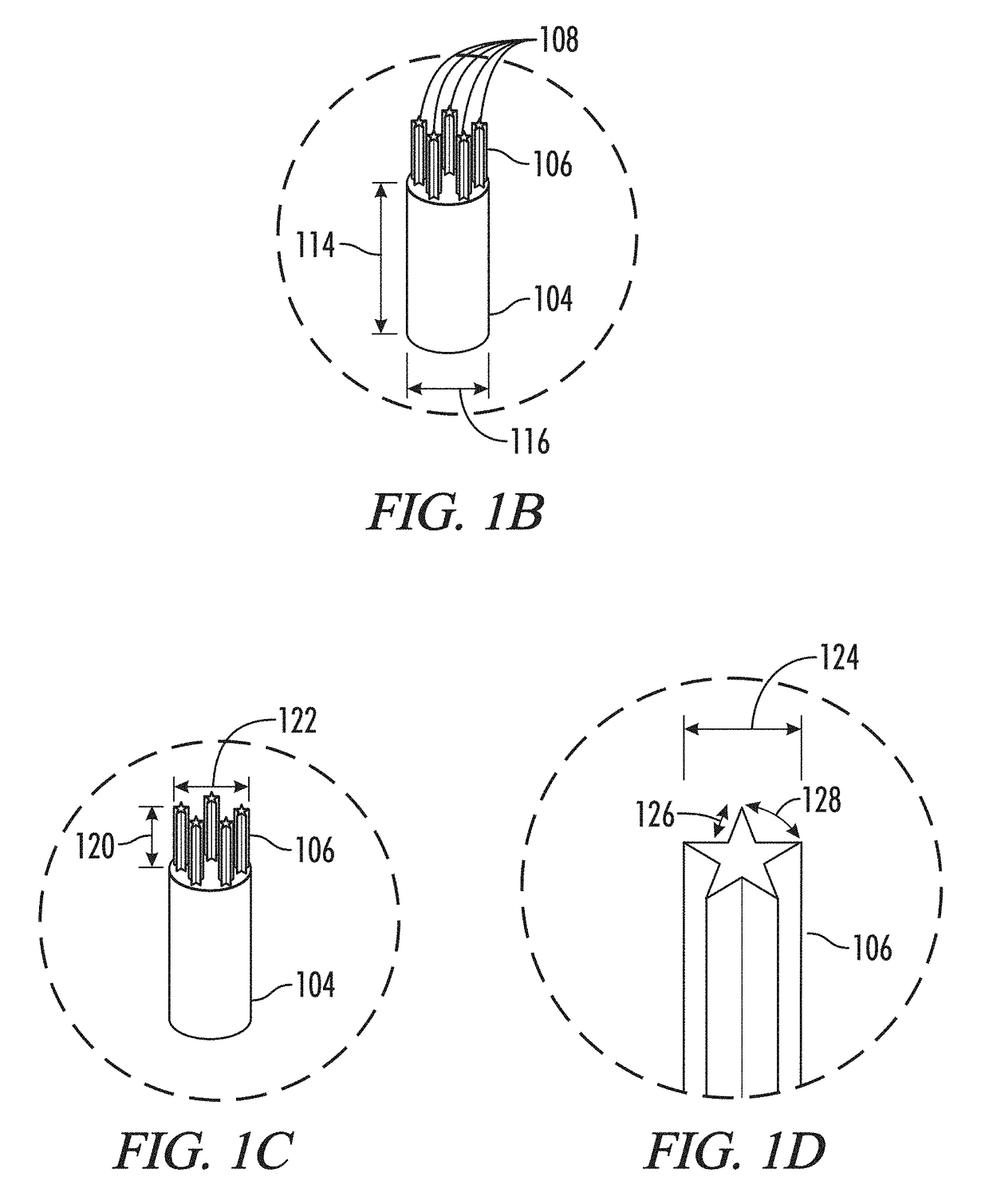 Stents with improved fixation