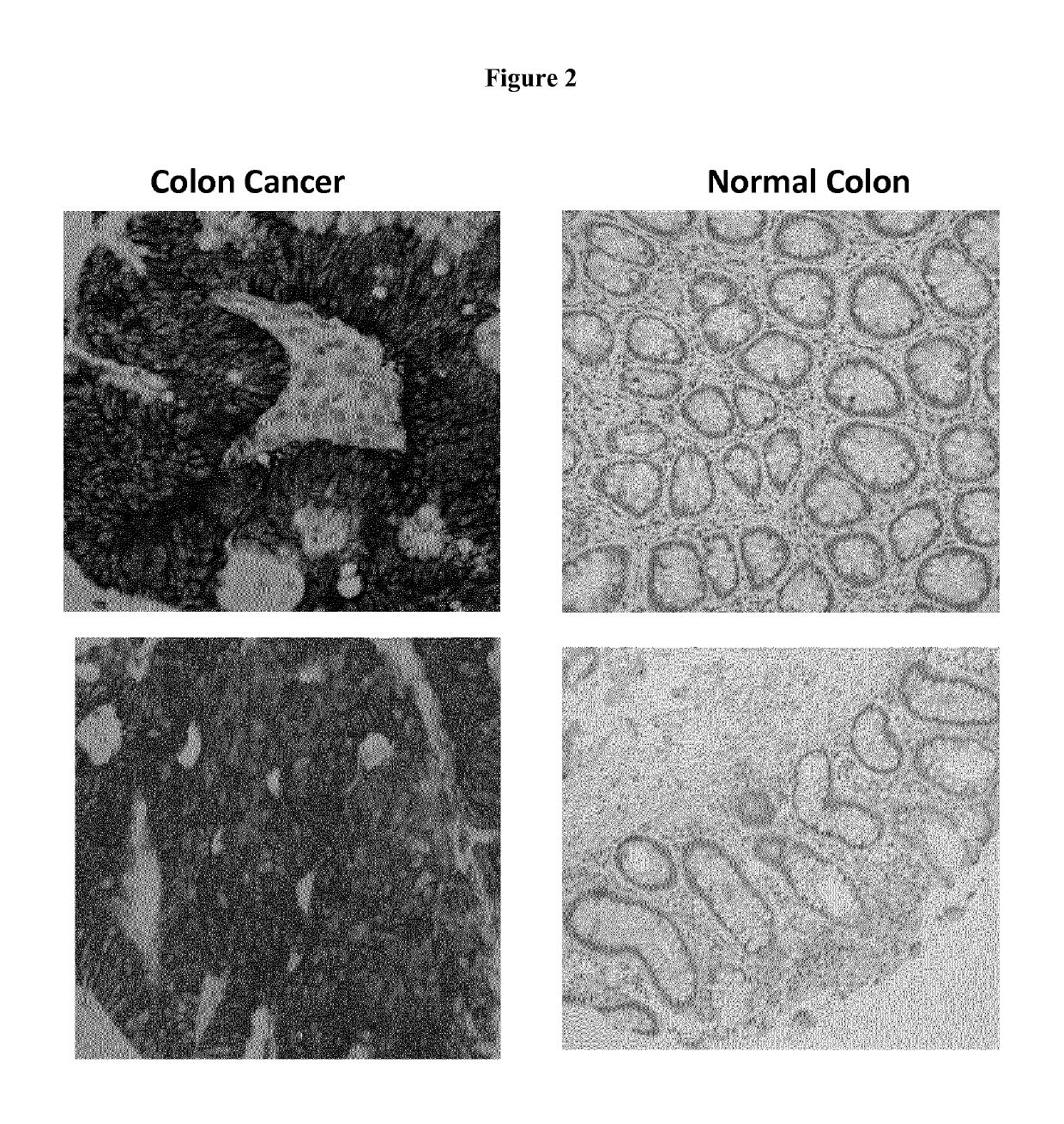 Tumor marker, monoclonal antibodies and methods of use thereof