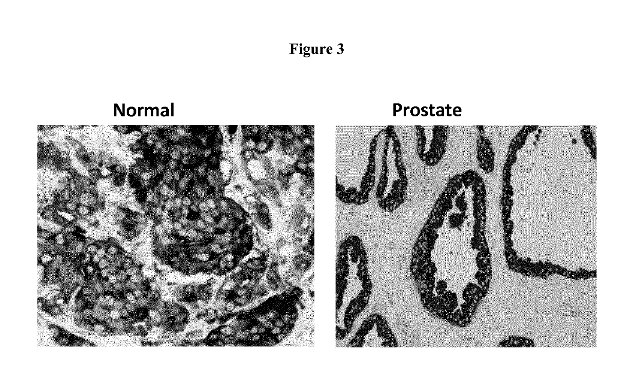 Tumor marker, monoclonal antibodies and methods of use thereof