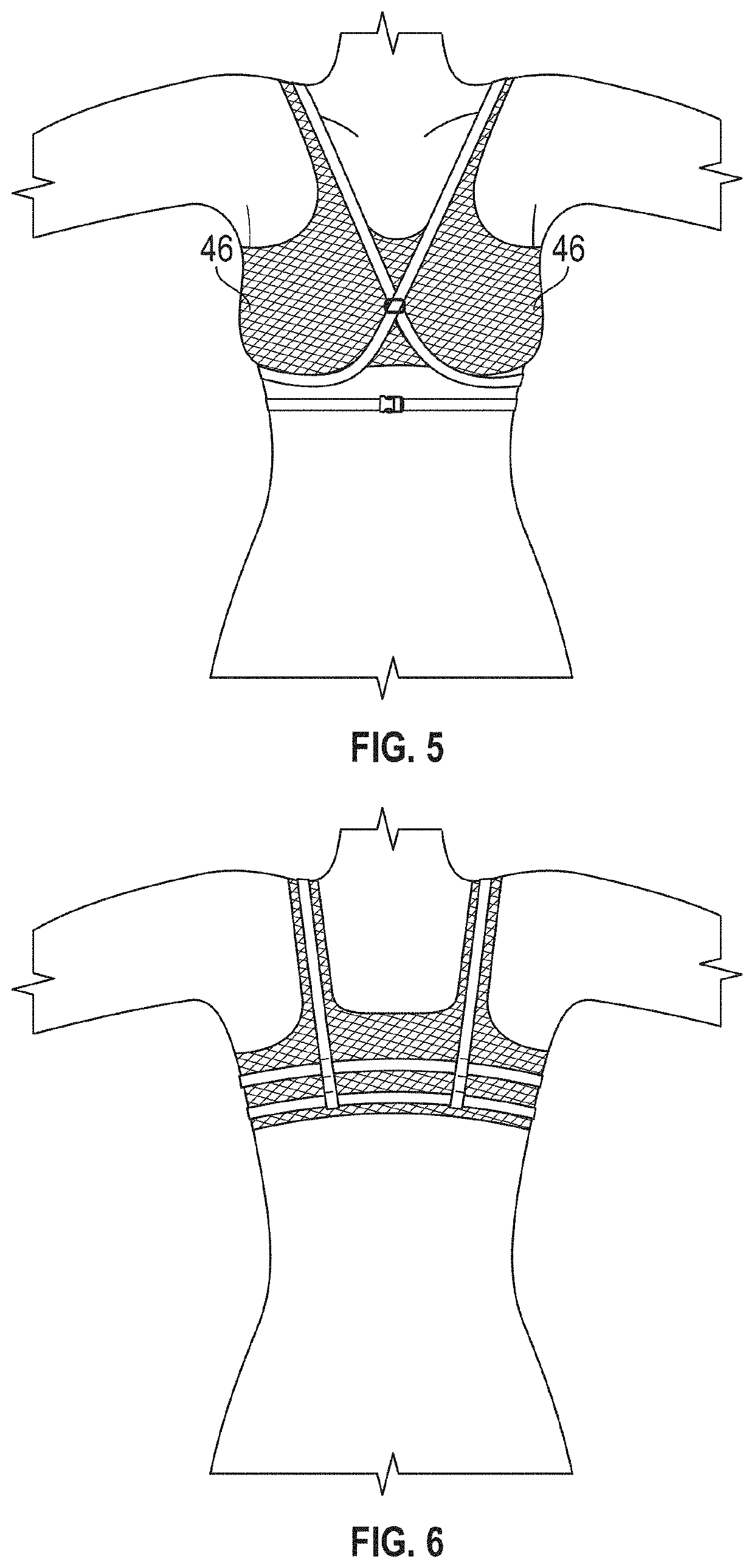 Augmentation mammoplasty postoperative system