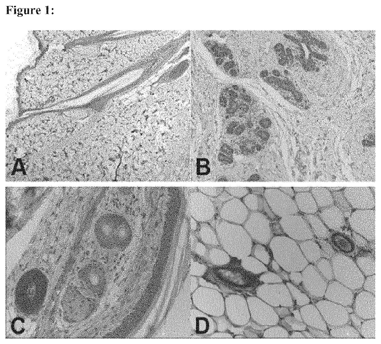 Prolactin receptor antibody for male and female pattern hair loss