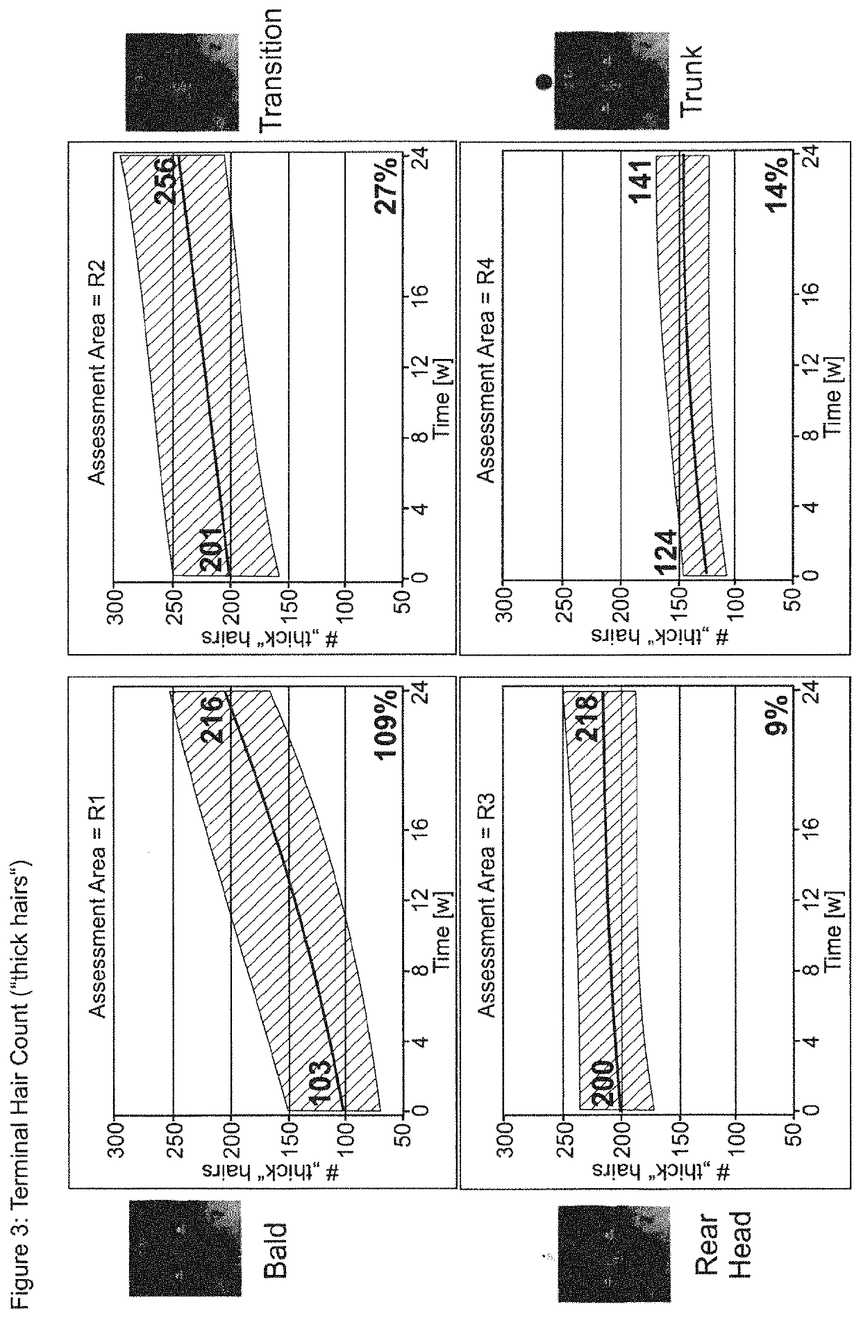 Prolactin receptor antibody for male and female pattern hair loss