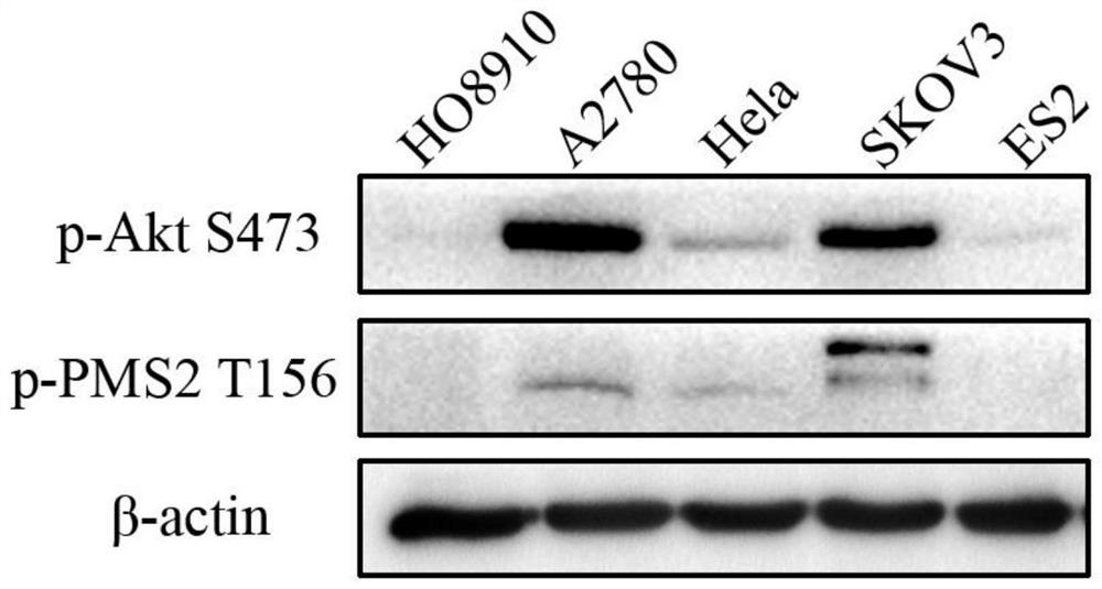 Application of Akt1 phosphorylated PMS2 protein as ovarian cancer treatment target