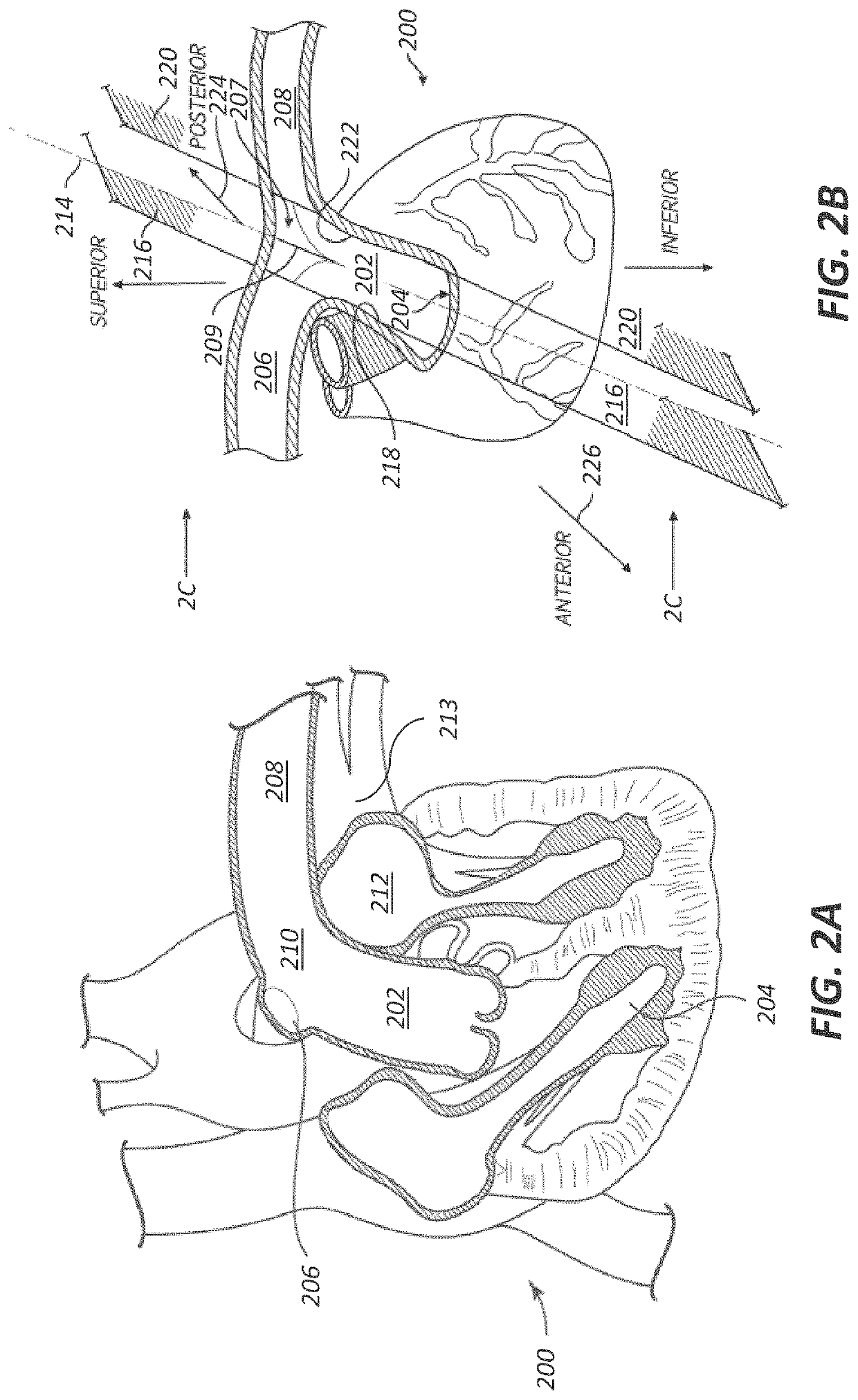 Partially woven expandable members