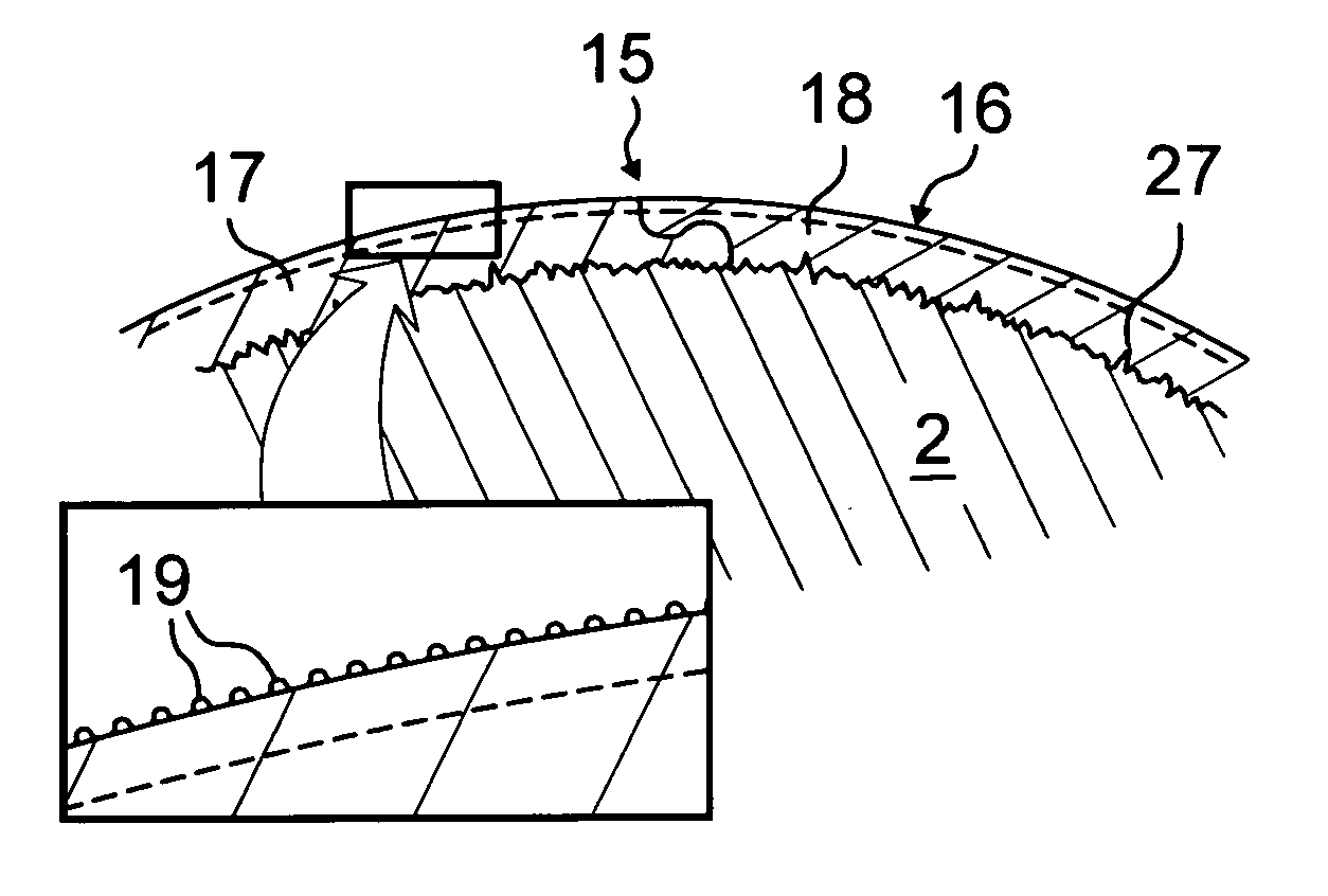 Orbital implant coating having differential degradation