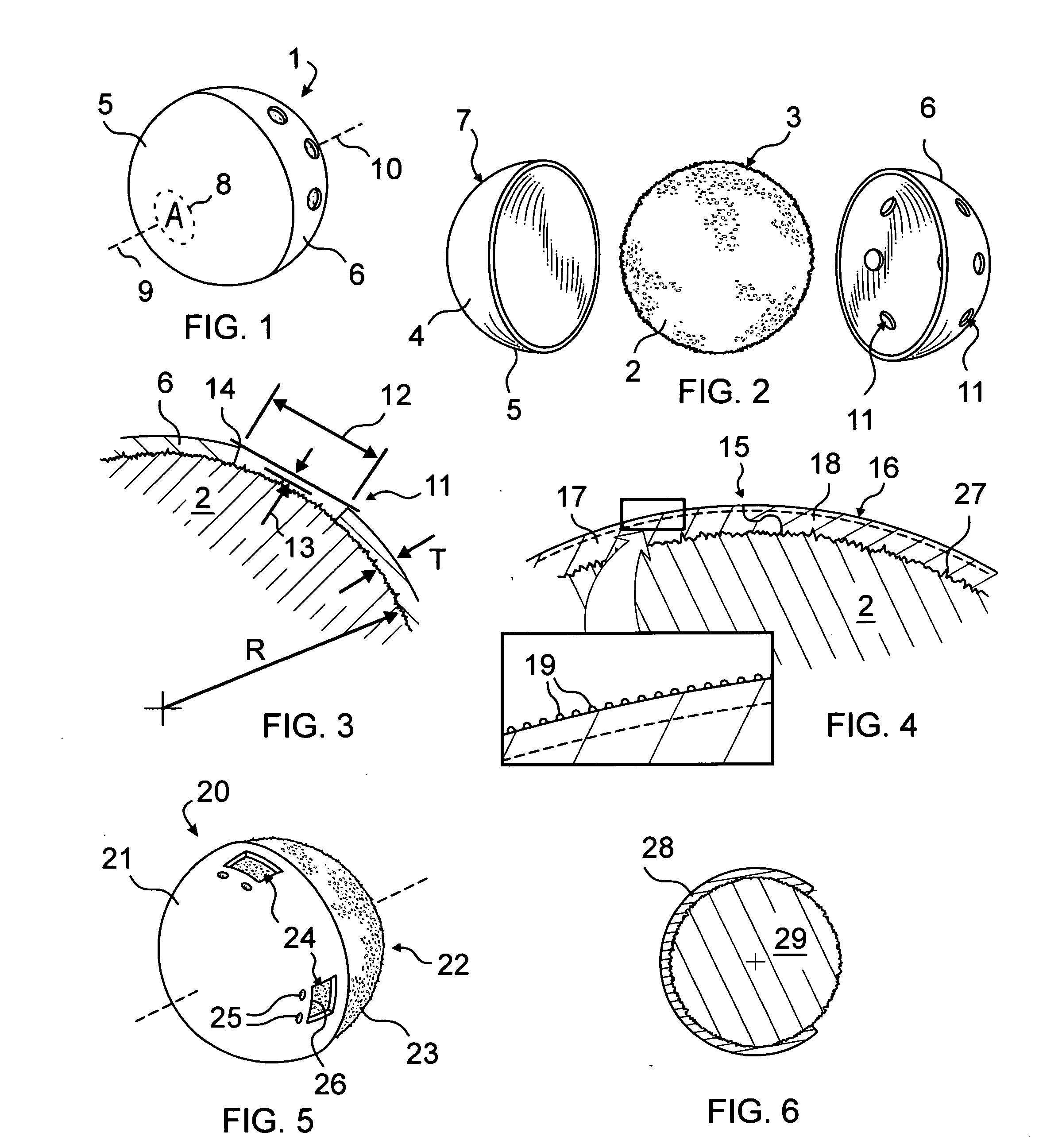 Orbital implant coating having differential degradation