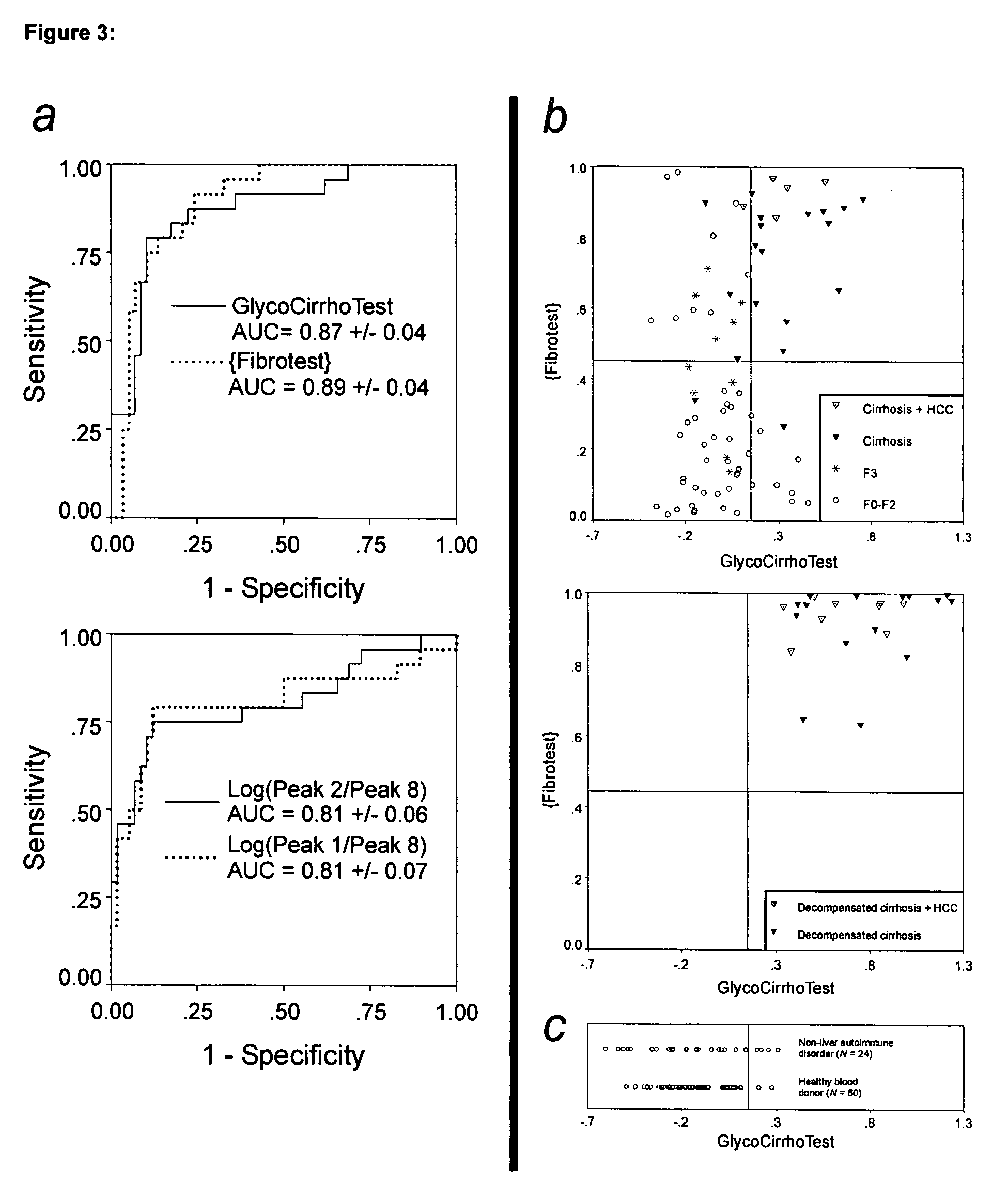 Serum marker for measuring liver fibrosis