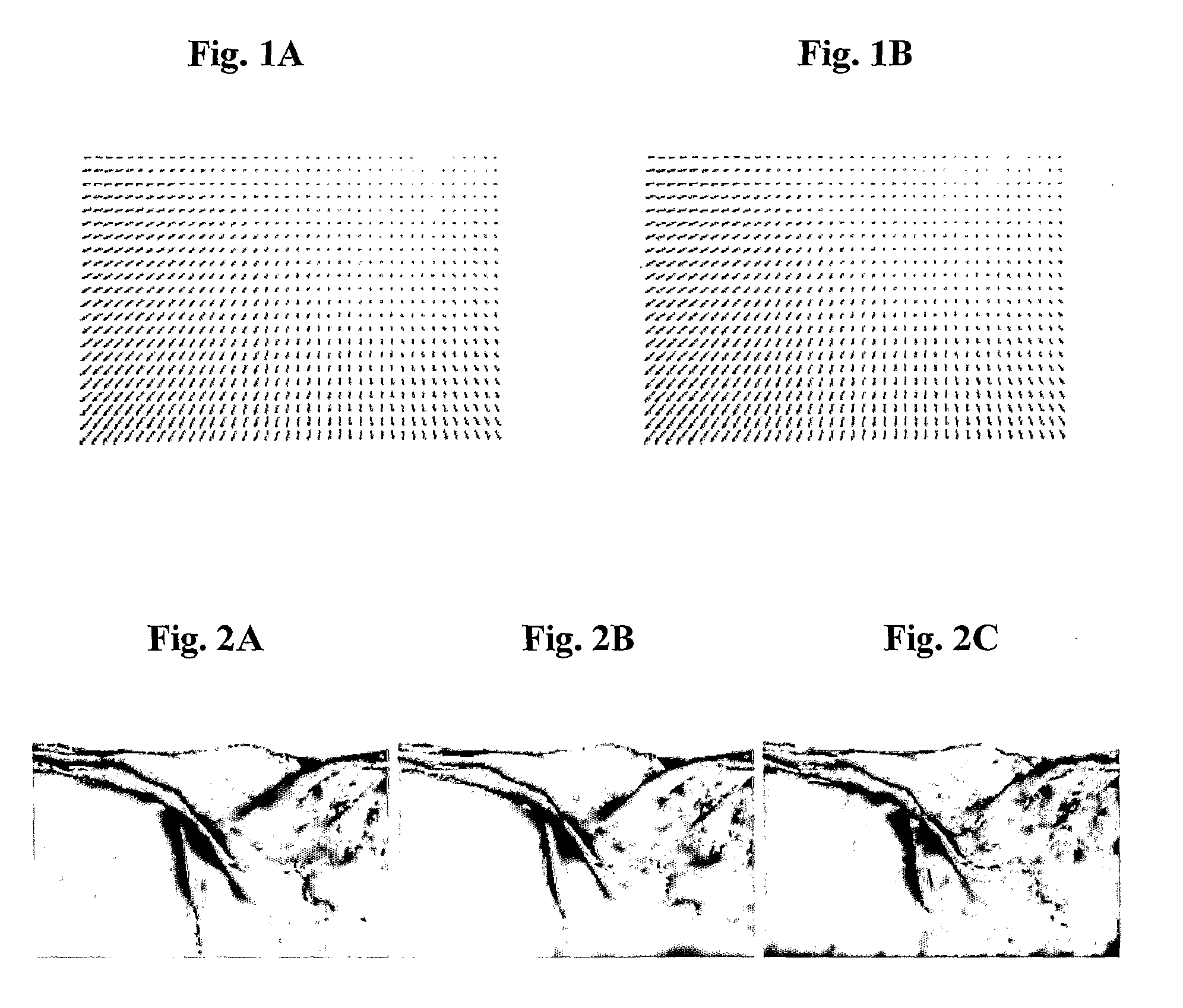 Over-Parameterized Variational Optical Flow Method