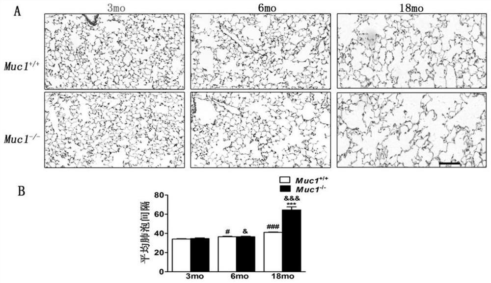 Application of mucoprotein MUC1 to preparation of drug with lung aging delaying effect