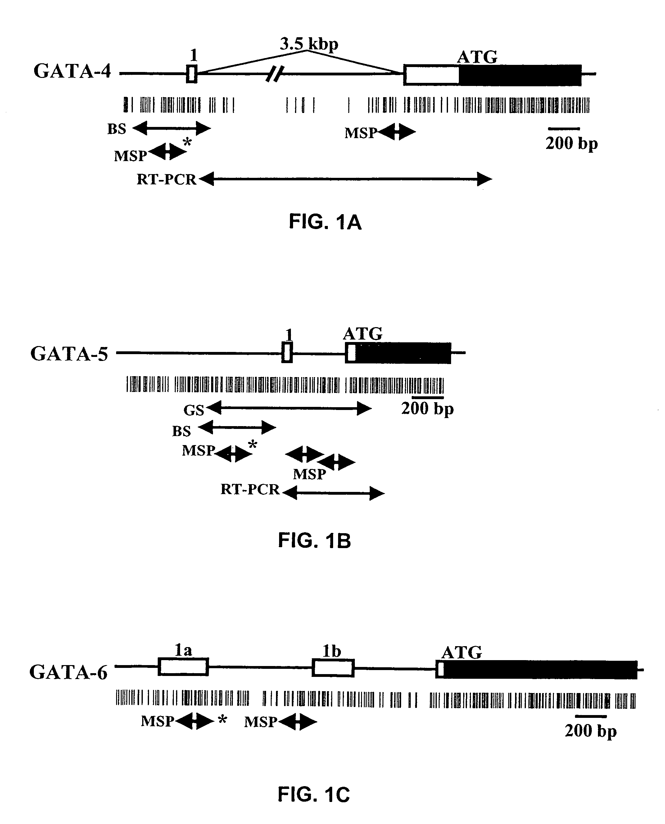 Hypermethylation of GATA-4 and GATA-5 transcription factor genes in cancer