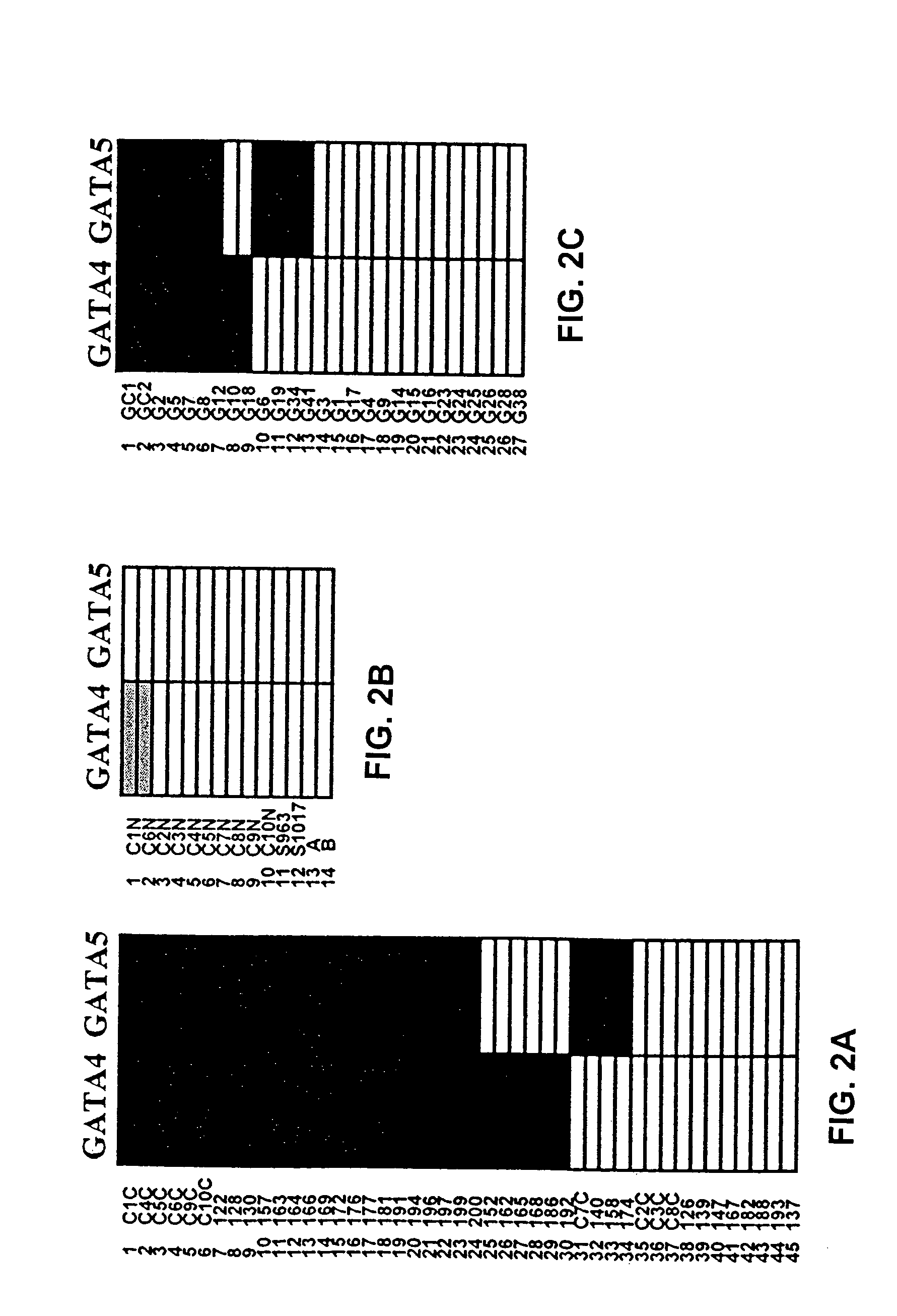 Hypermethylation of GATA-4 and GATA-5 transcription factor genes in cancer