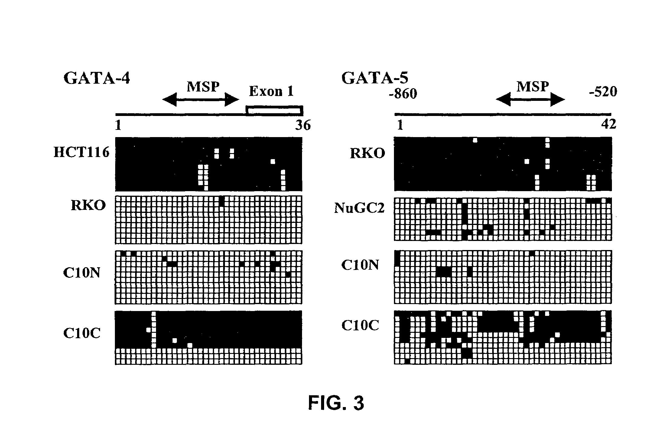 Hypermethylation of GATA-4 and GATA-5 transcription factor genes in cancer