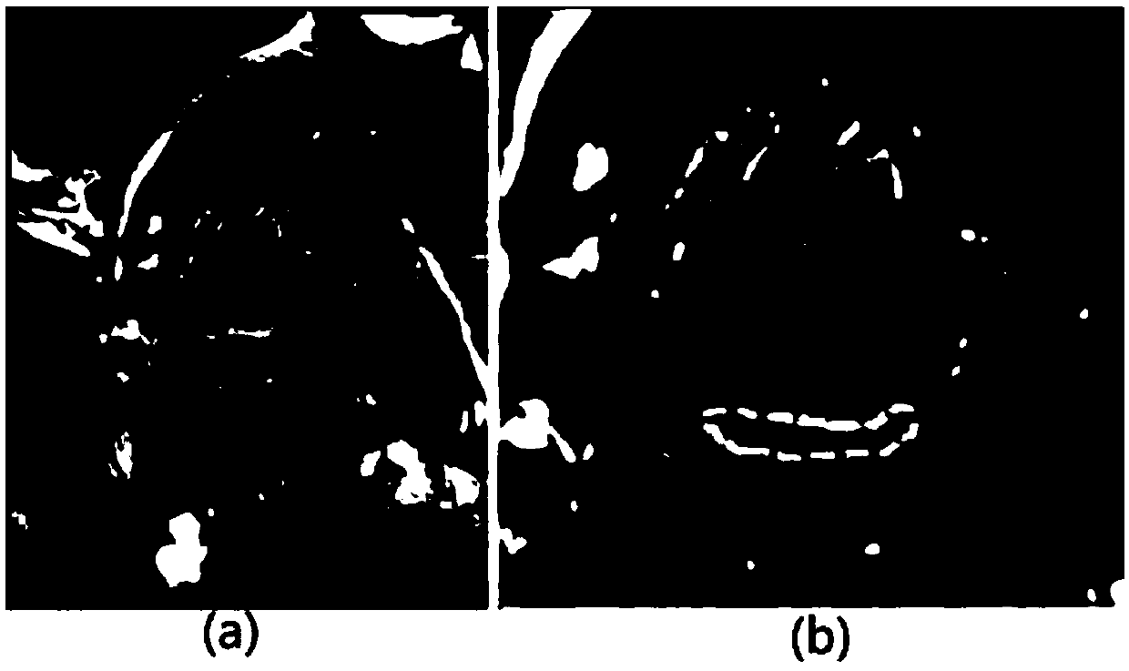 Non-invasive cardiac infarction classification model construction method based on stack type self-encoder and support vector machine