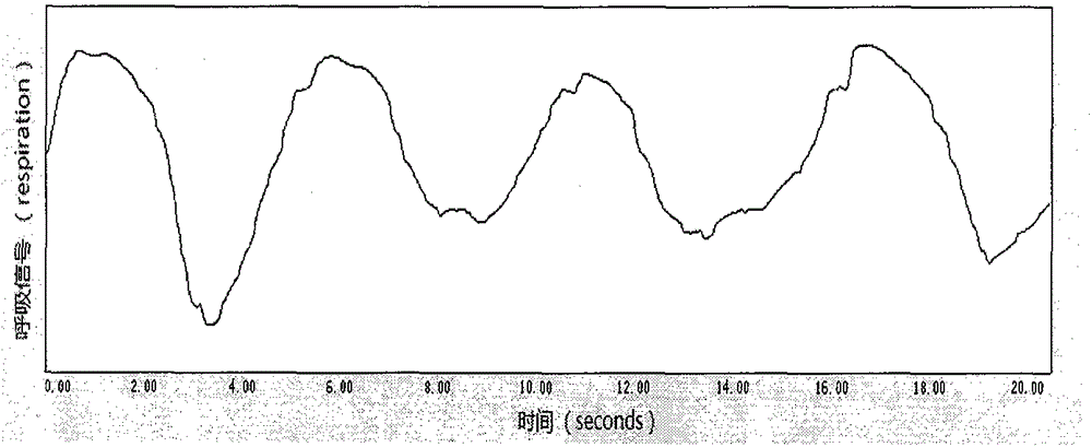 Non-contact human respiration and heart beat signal detection method based on infrared sequence image