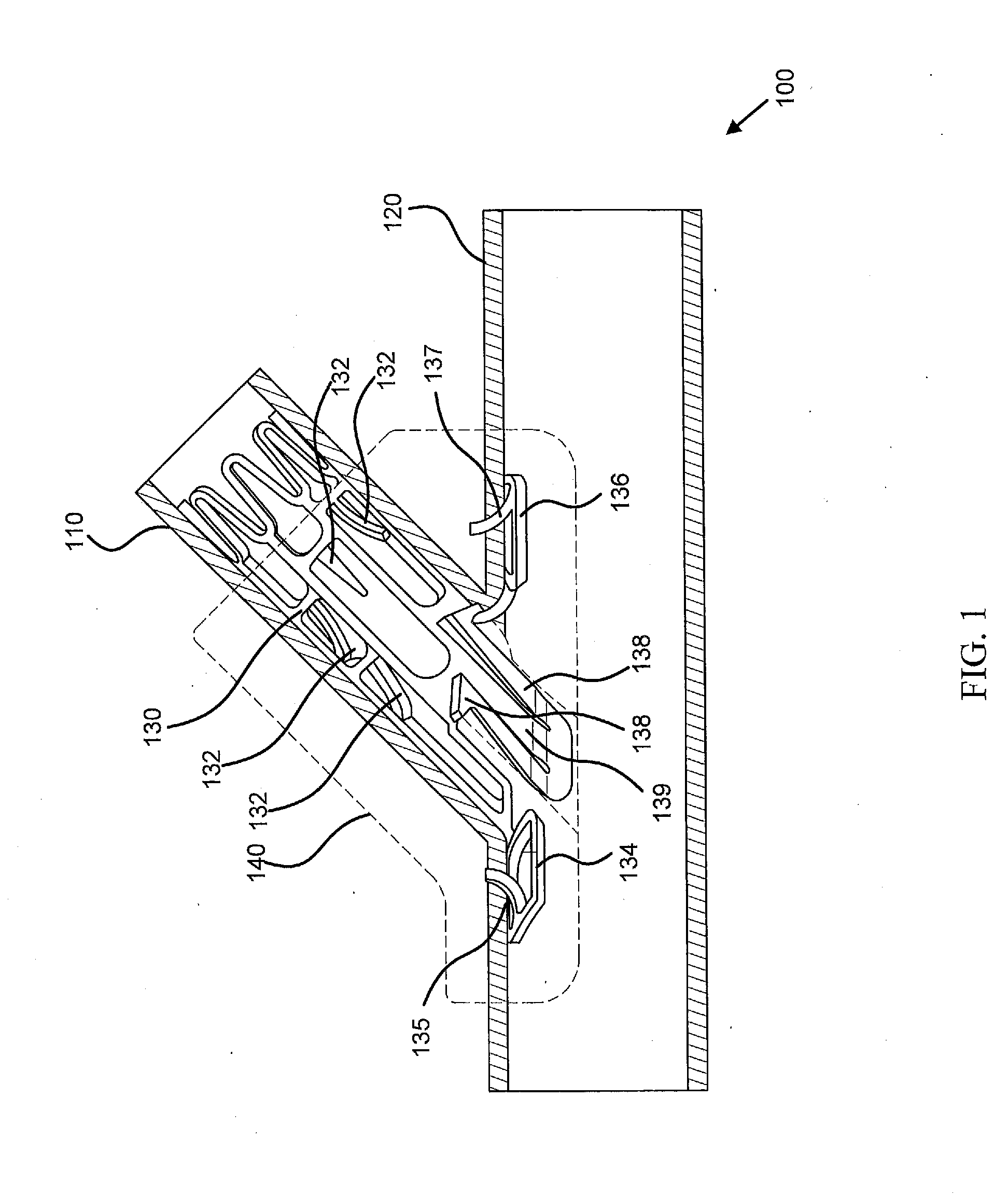 Sutureless vascular anastomosis connection