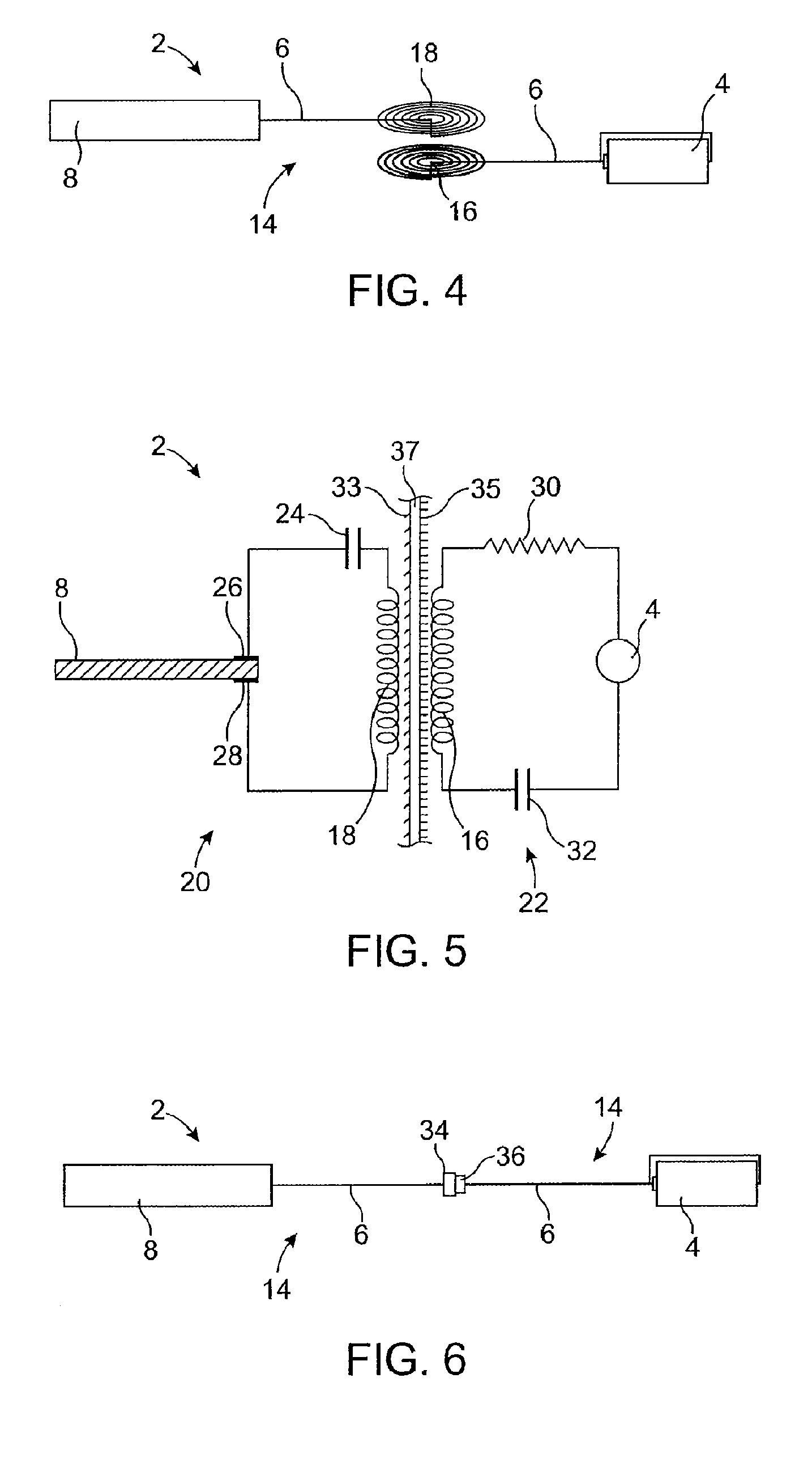 On-off implant for supporting the airway