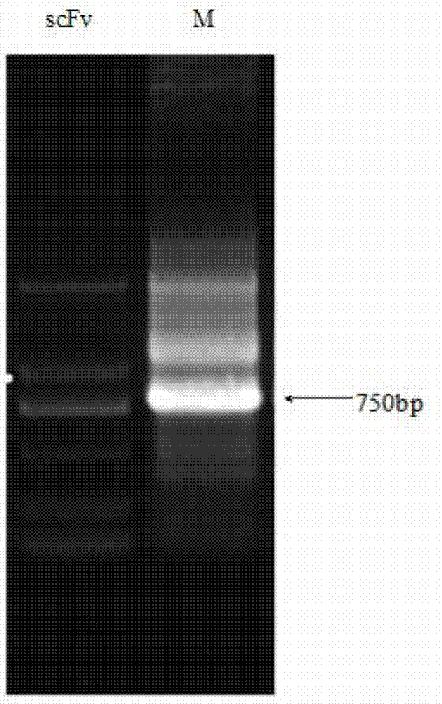 Antibody gene for resisting pyrethriods pesticide scFv (Single Chain Fragment Variable) and application of antibody gene