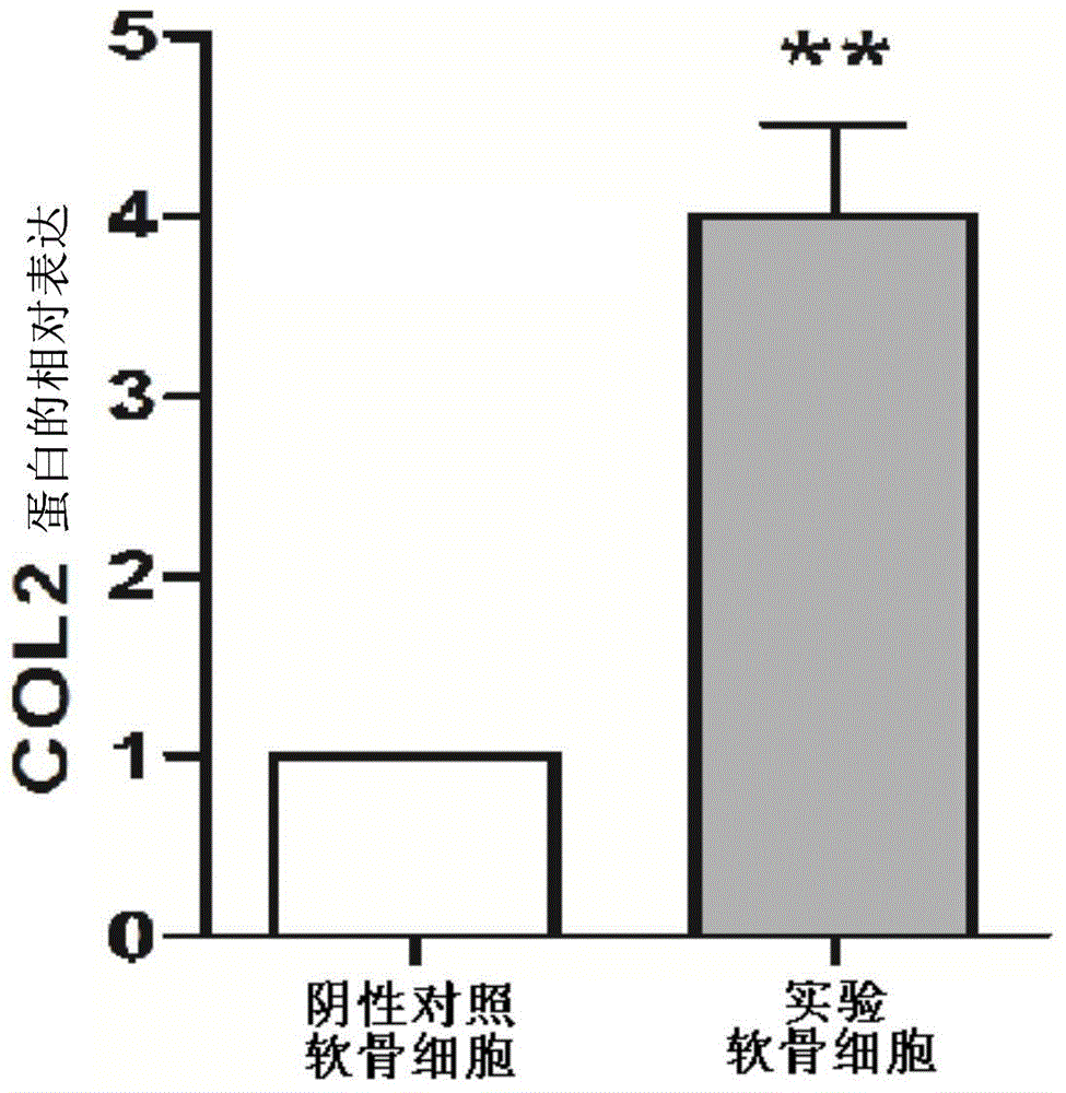 Inhibitor for lncRNA-MSR and application of inhibitor