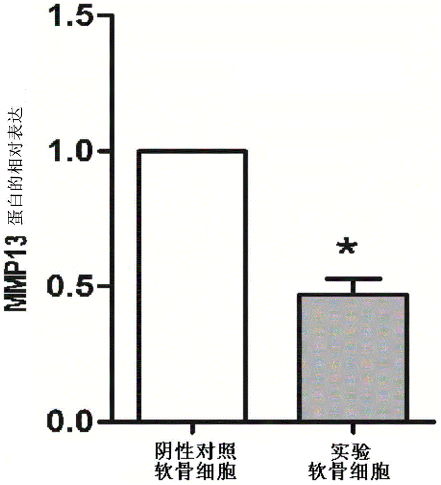 Inhibitor for lncRNA-MSR and application of inhibitor