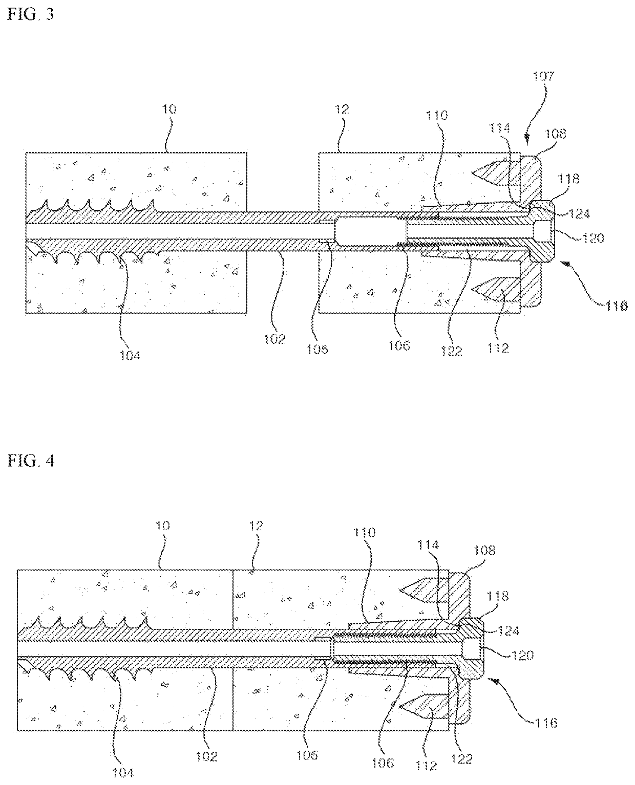 Bone fusion device