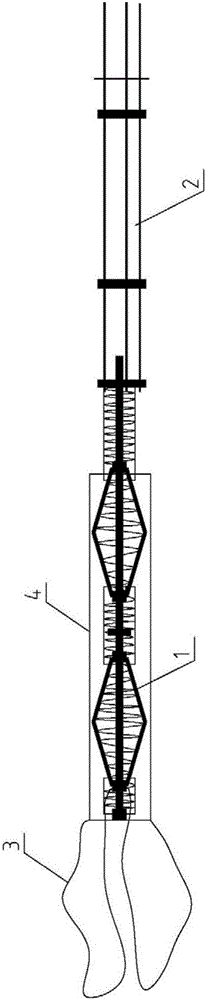 A recyclable head-expanding bolt and its construction method