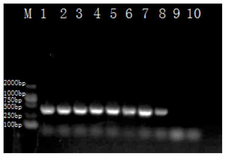 PCR detection primer and kit for Cedecea neteri and application of PCR detection primer and kit