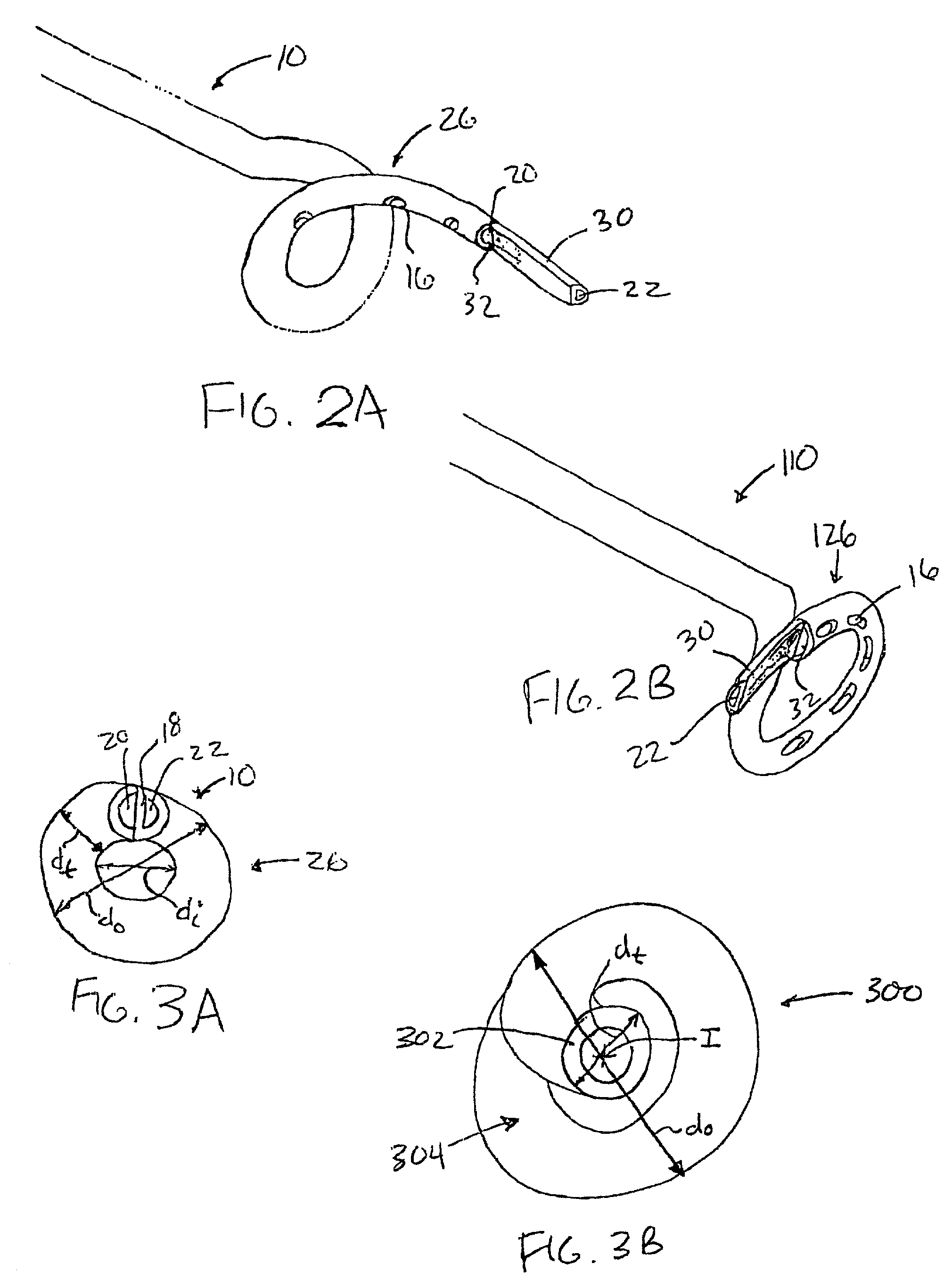 Occlusion-resistant catheter