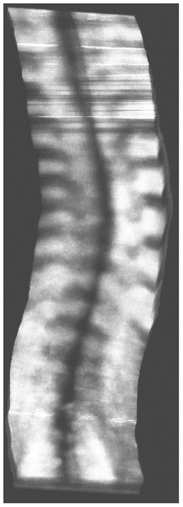 Spinal curvature angle measurement method