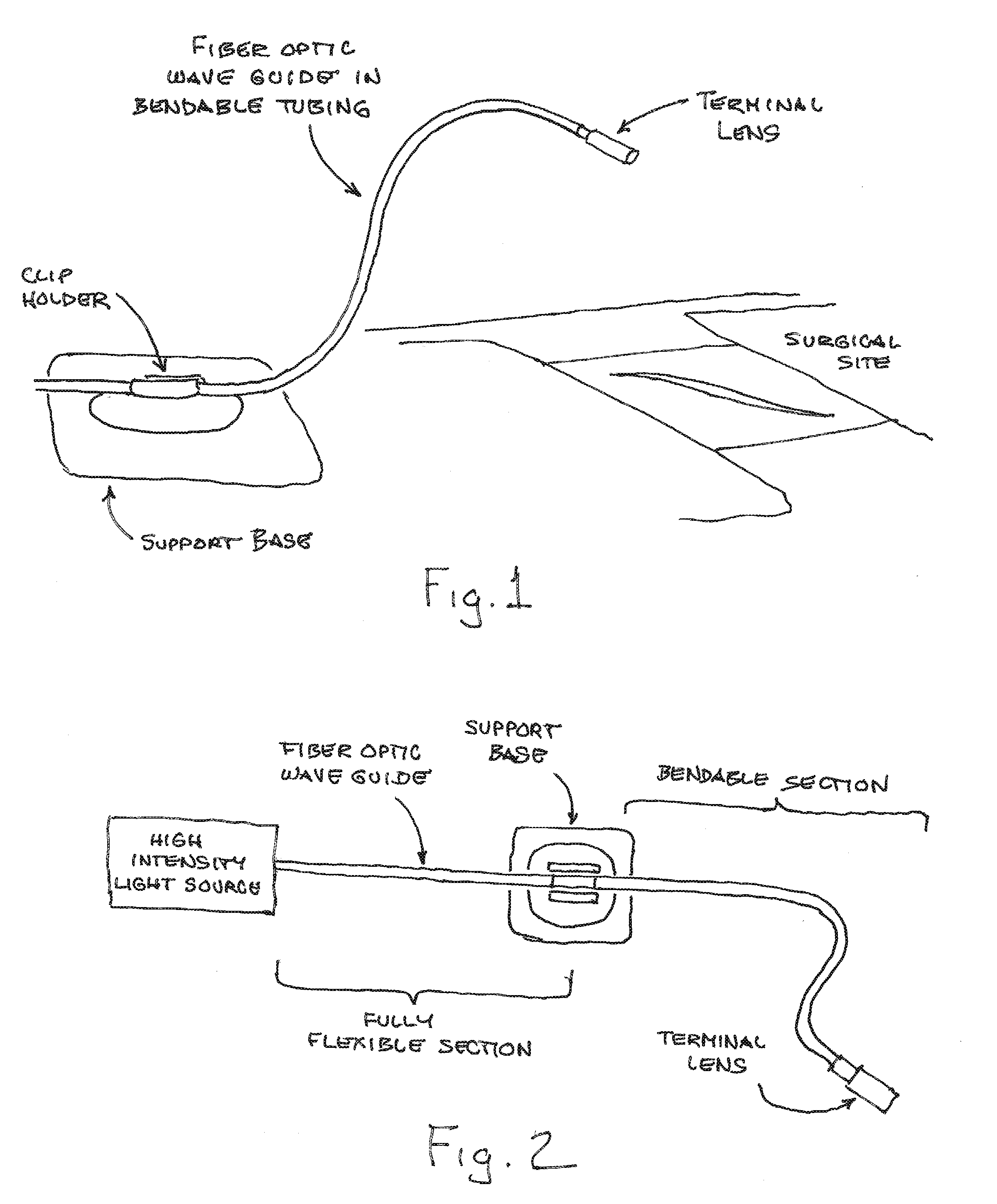 Malleable Surgical Assistance Devices