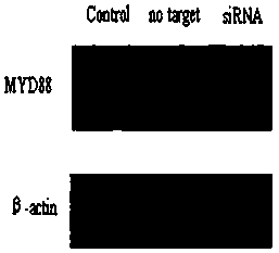 Oligomer nucleic acid for suppressing myd88 gene and its application