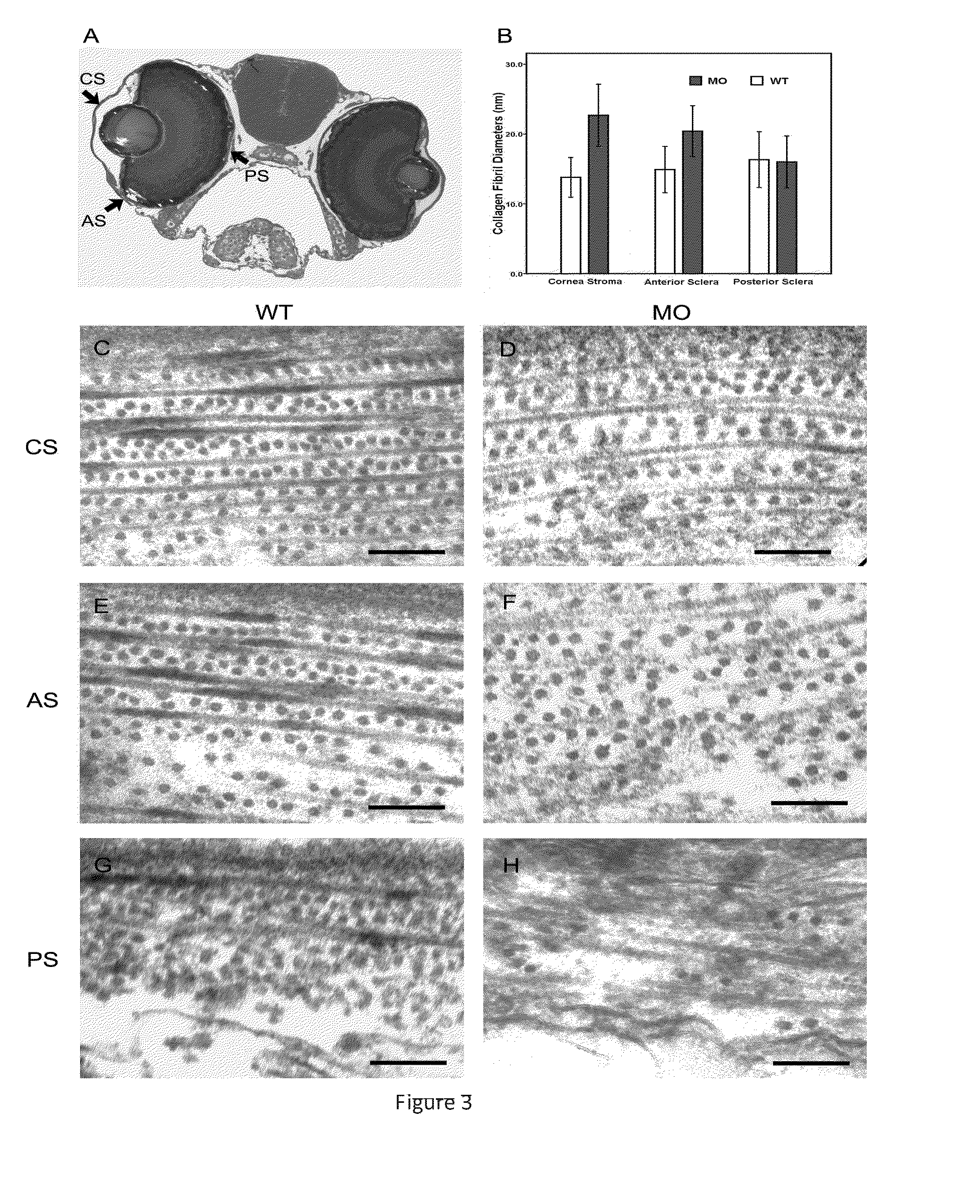 Methods for drug screen using zebrafish model and the compounds screened therefrom