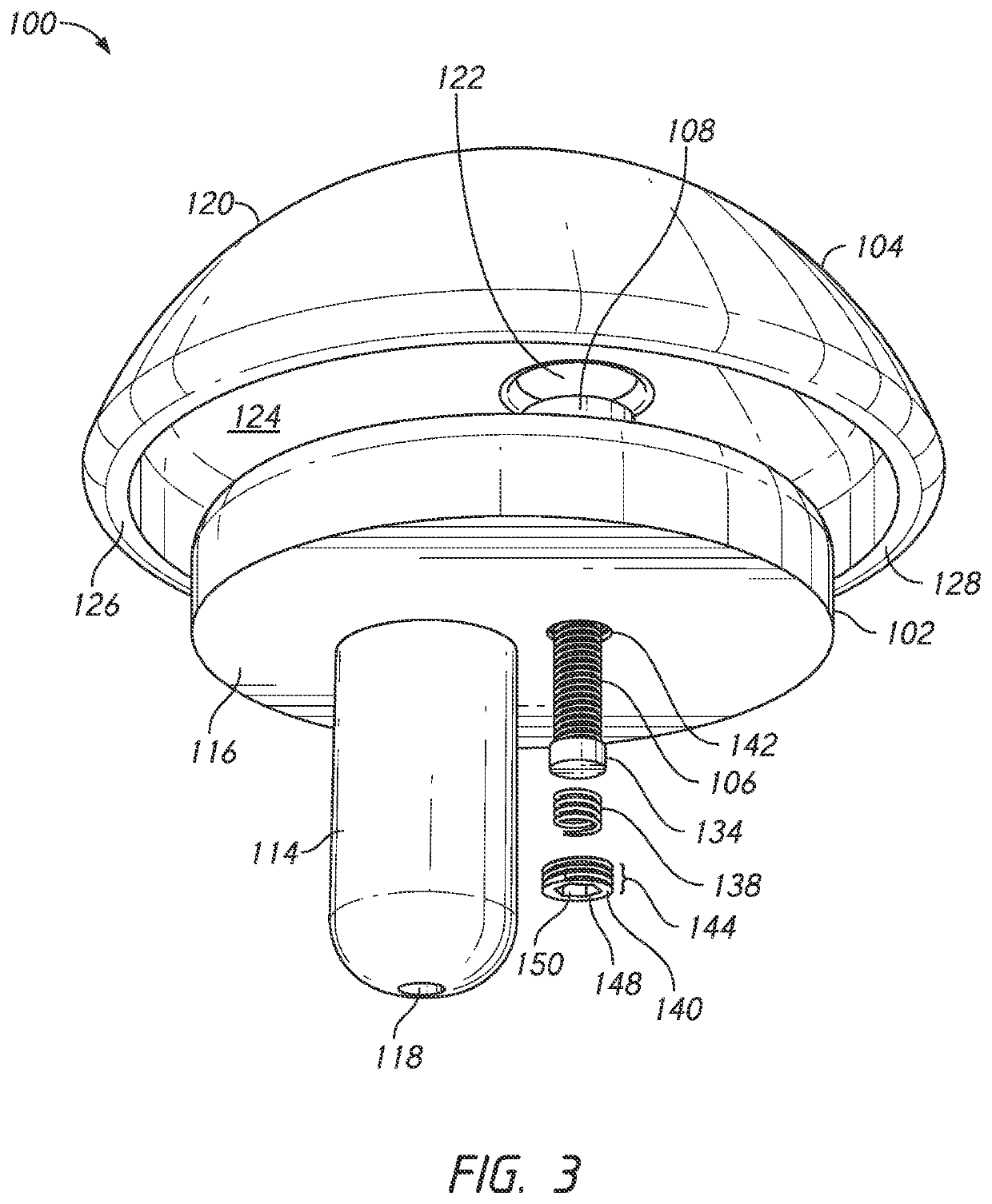 Shoulder implants and methods of use and assembly