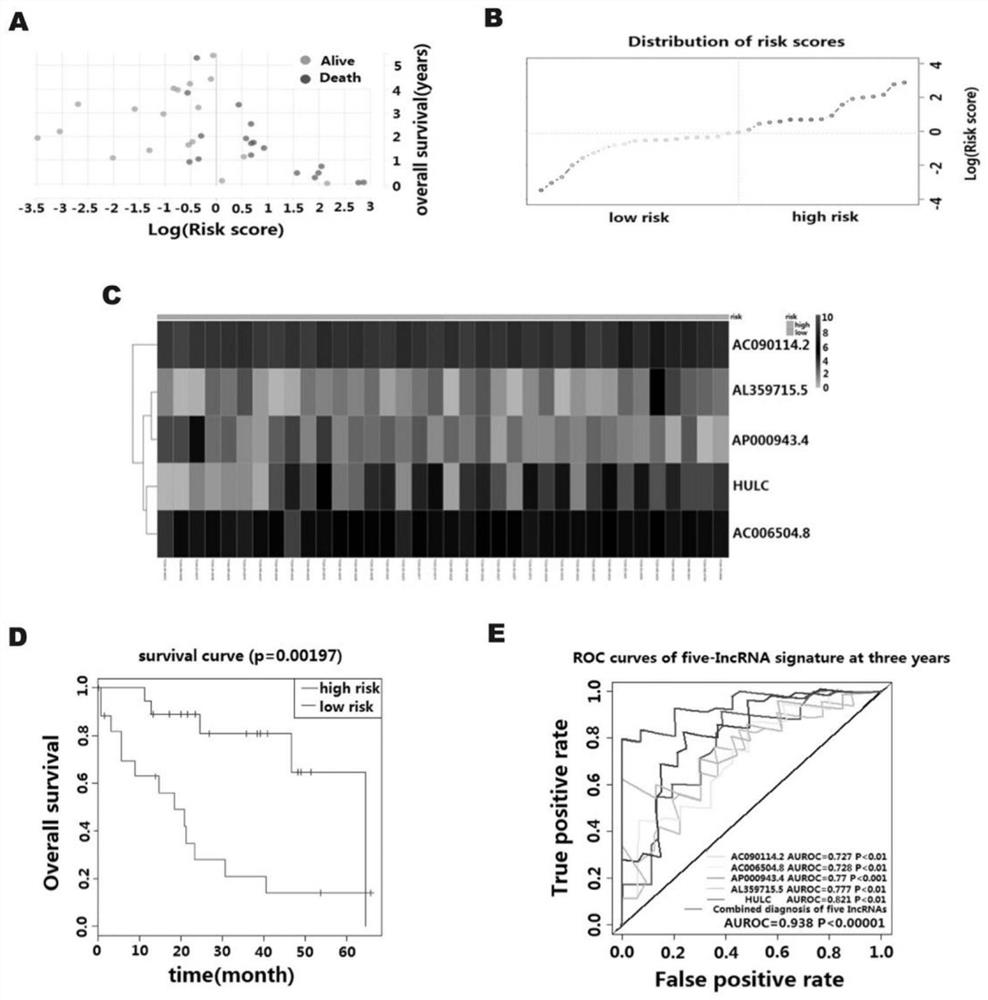 Biliary duct cancer prognosis determination marker, detection primer, kit and application