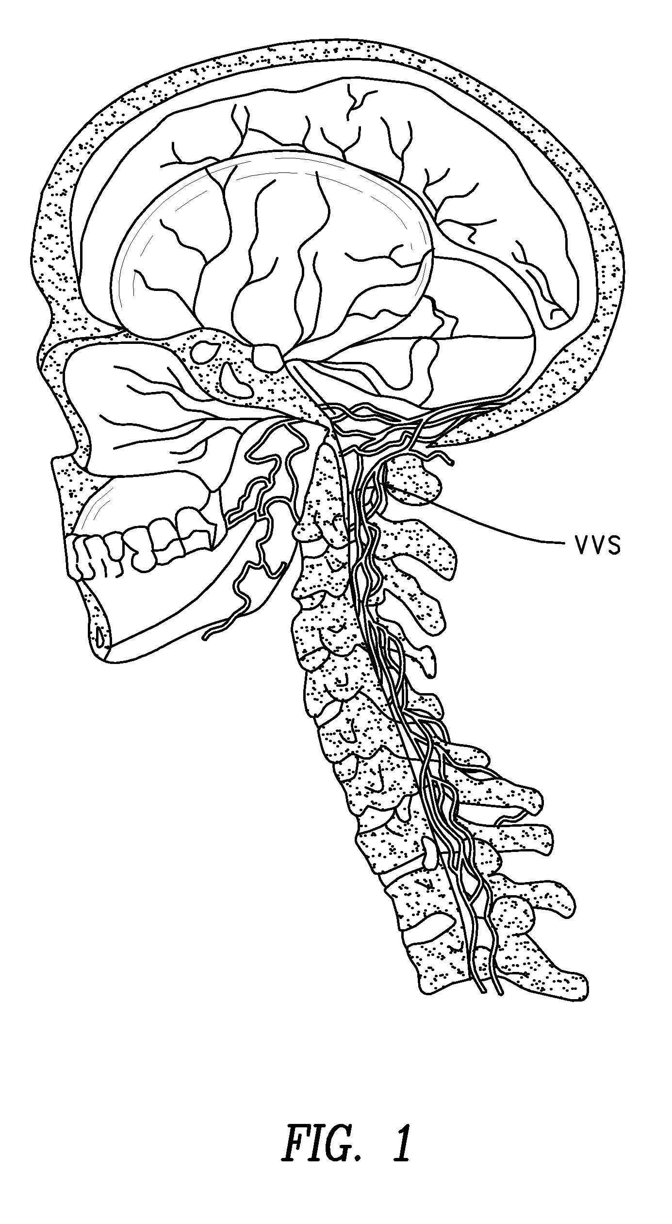 Methods for treatment of brain injury utilizing biologics