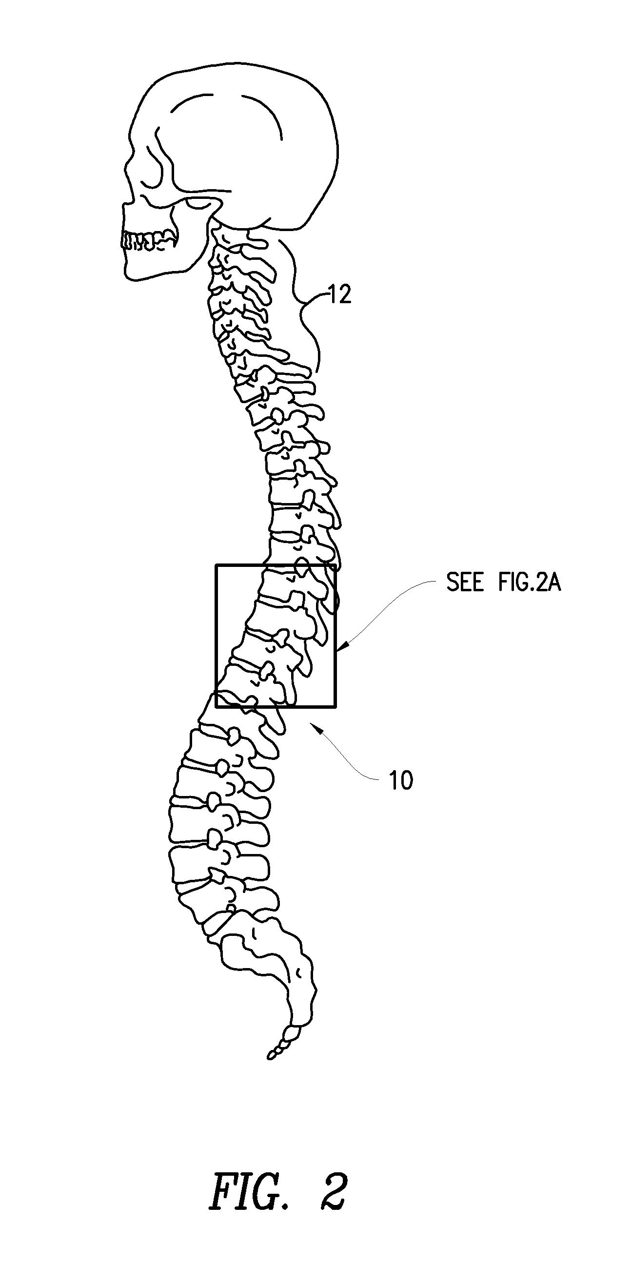 Methods for treatment of brain injury utilizing biologics