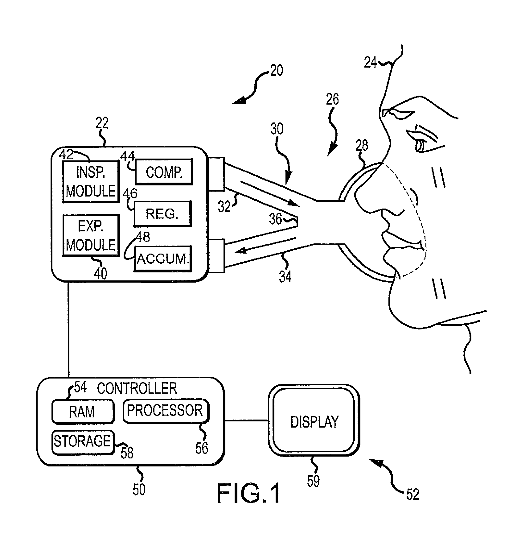 Ventilator Respiratory Variable-Sized Gas Accumulator