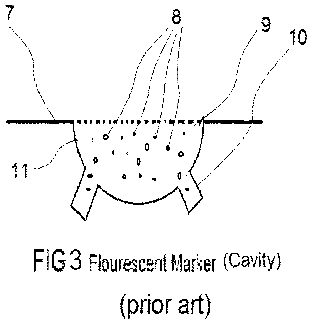 Method and system for item marking and identification