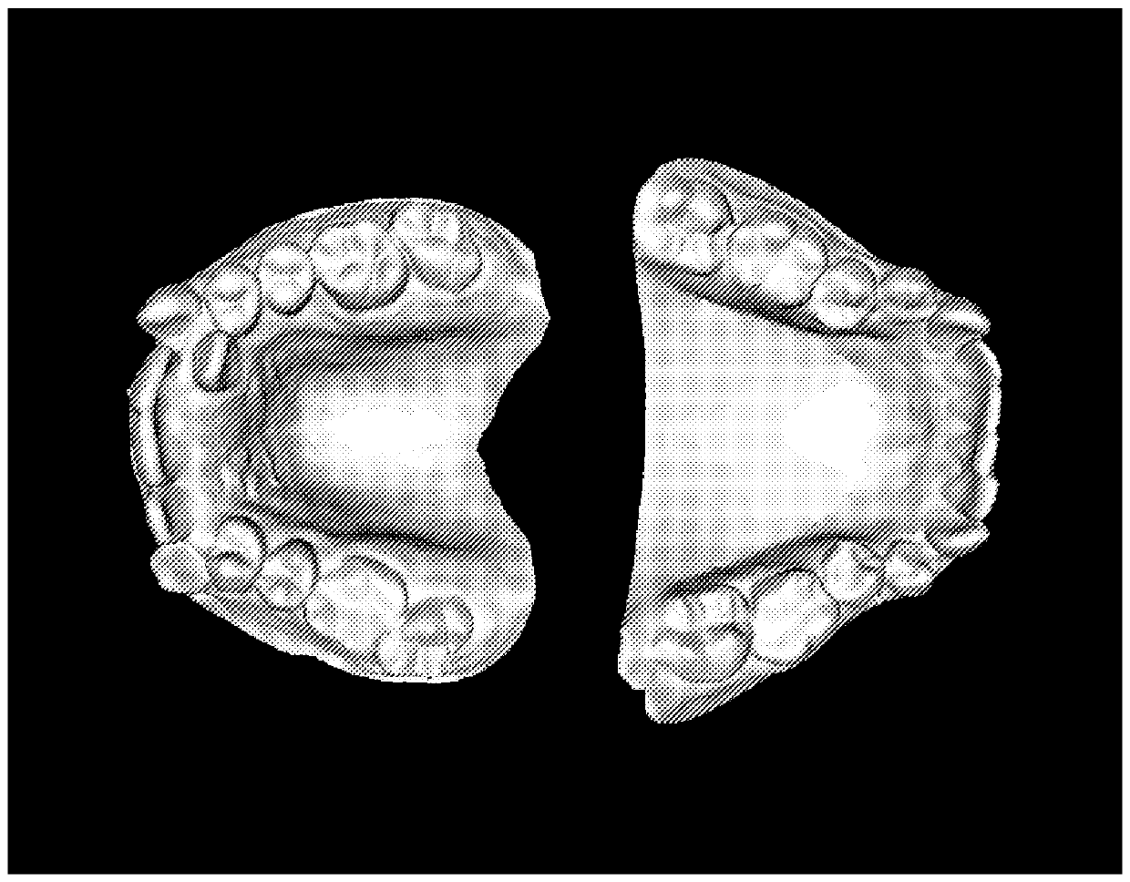 Dynamic dental arch map