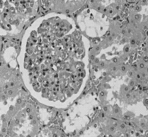 Chinese herbal compound functional food for adjuvant therapy of diabetes and preparation method thereof