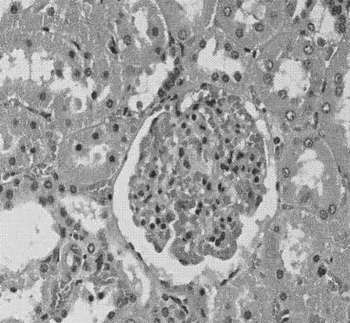 Chinese herbal compound functional food for adjuvant therapy of diabetes and preparation method thereof