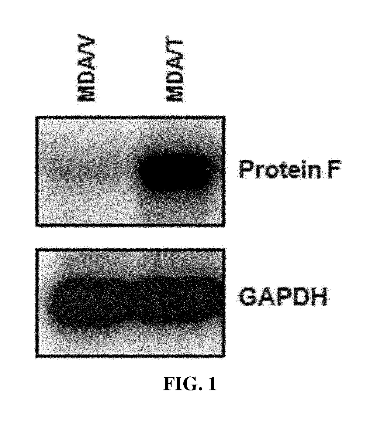 Pharmaceutical composition for preventing and treating cancer or cancer metastasis, containing fstl1 protein as active ingredient