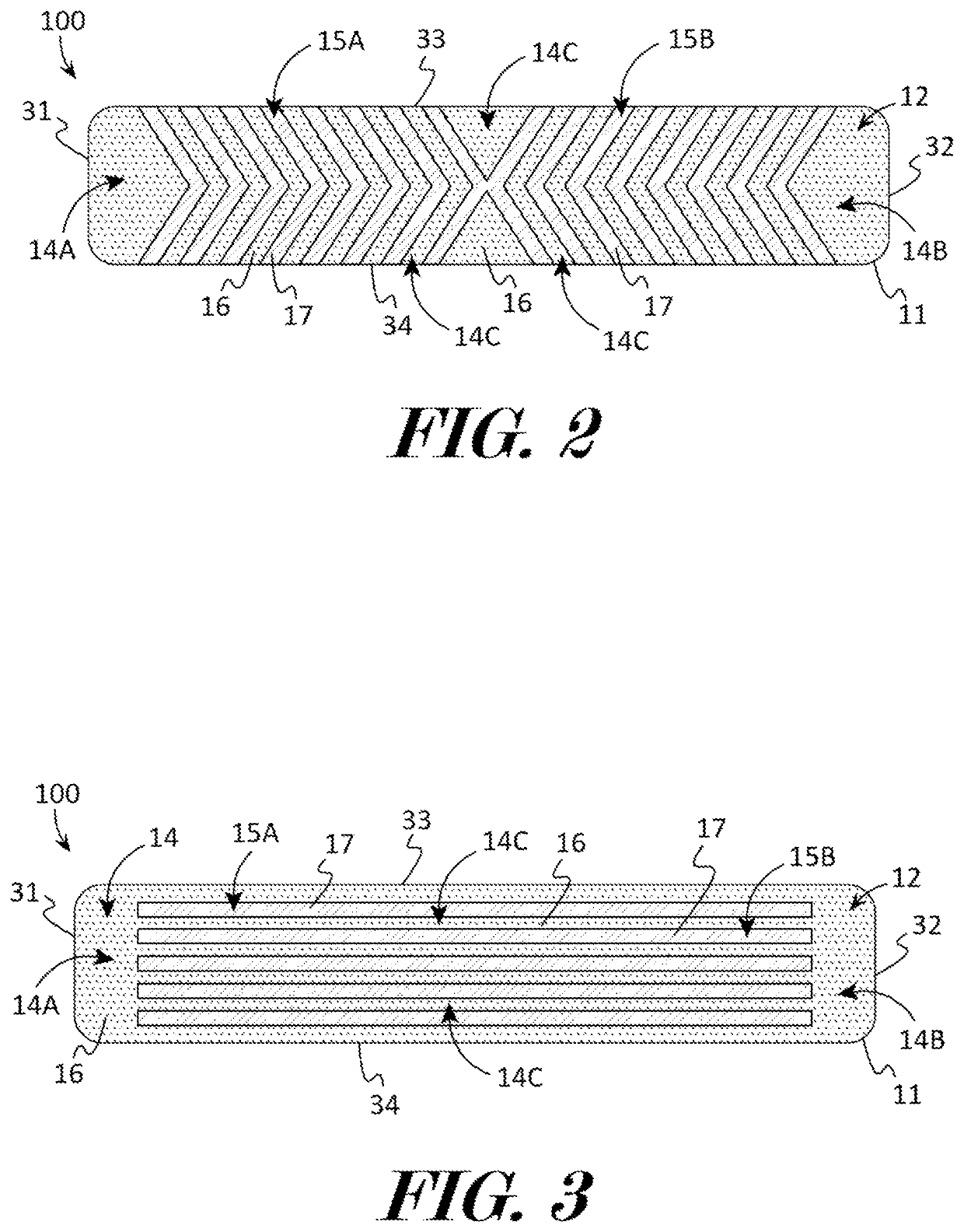 Clothing alteration device and method